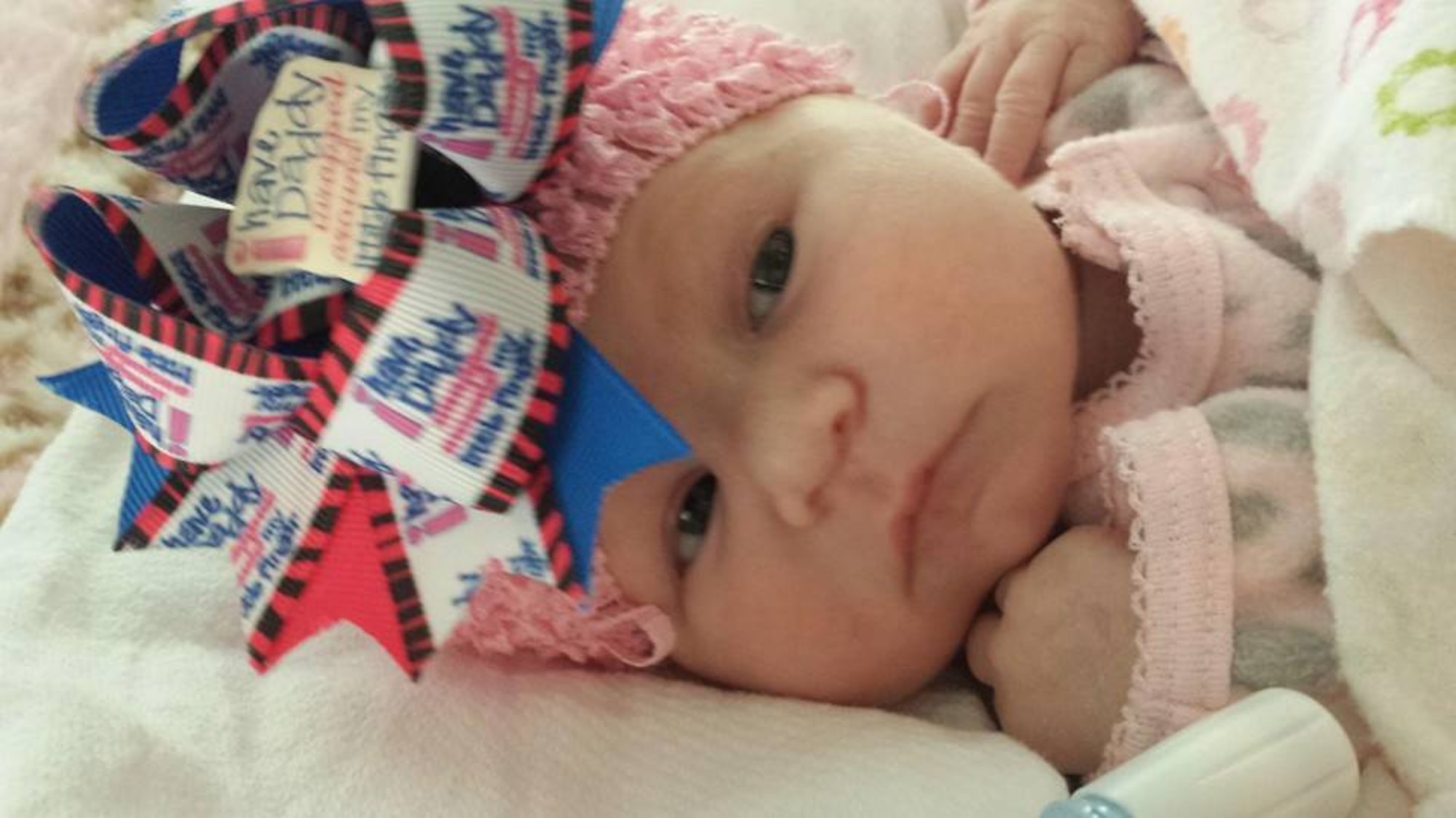 Angelina Pemberton, daughter of Tech. Sgt. Michael Pemberton, an assistant flight chief for Minot Air Force base’s 91st Missile Security Forces Squadron, and his wife Renée lays on a blanket. Angelina was born with Bilateral Renal Agenesis; a condition where the kidneys do not develop in the womb. (Courtesy photo)