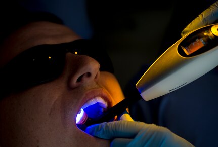 Airman 1st Class Craig Luce, 437th Ariel Port Squadron cargo processor, opens wide while Lea Gillis, 628th Medical Group dental assistant, uses a curing light on his tooth Apr. 16, 2014, at the 628th Medical Group dental clinic on Joint Base Charleston – Air Base, S.C. When a dentist gives a patient a white filling, it is in a liquid or semi-solid state so the dentist can put it exactly where it needs to go and shape it correctly. In order for the material to harden, it needs to be cured. (U.S Air Force photo/ Airman 1st Class Clayton Cupit