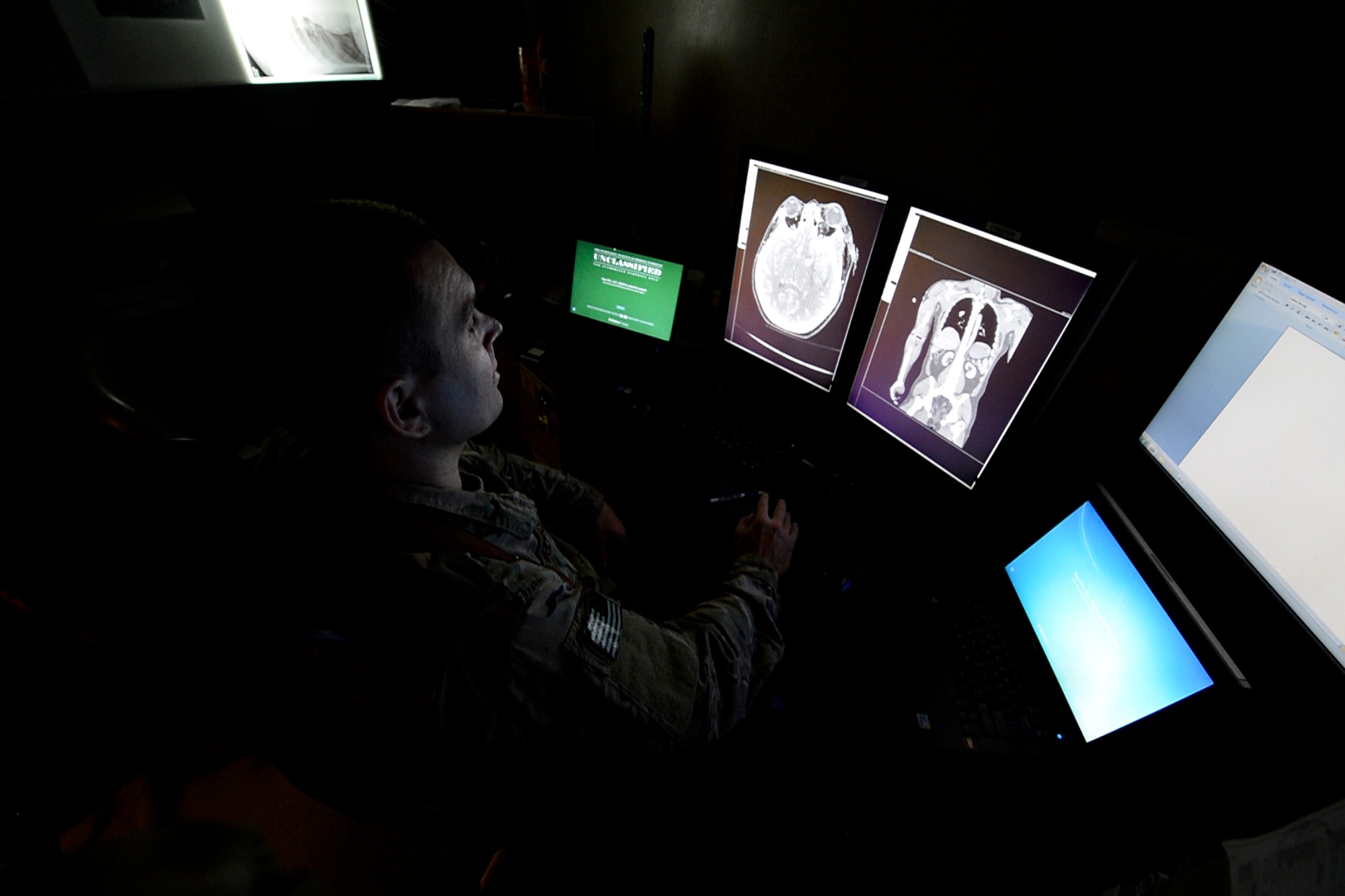 U.S. Air Force Maj.  Shane Newberry, 455th Expeditionary Medical Support Squadron deputy flight commander, reviews a patient’s x-ray images at Bagram Airfield, Afghanistan July 24, 2014. Radiologists at the Craig Joint Theater Hospital are responsible for providing a variety of imaging expertise such as x-rays, ultrasound, and fluoroscopy for patients. Newberry is deployed from Joint Base San Antonio, Texas and a native of Las Vegas, Nev. (U.S. Air Force photo by Staff Sgt. Evelyn Chavez/Released)