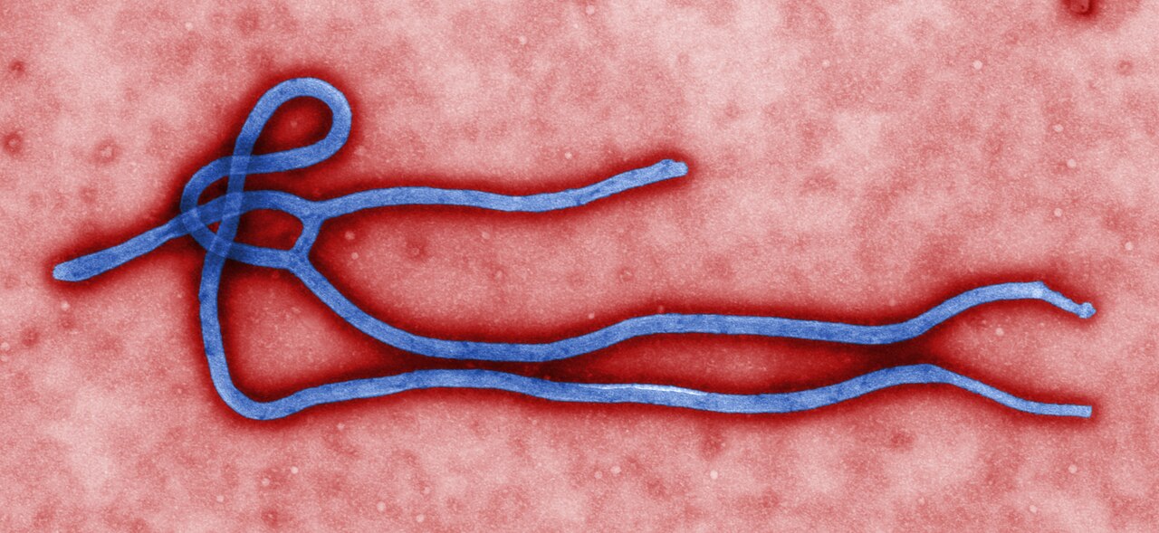 This colorized transmission electron micrograph shows some of the morphology displayed by the Ebola virus. The exact origin, locations and natural reservoir of Ebola virus remain unknown. Centers for Disease Control and Prevention photo by Cynthia Goldsmith