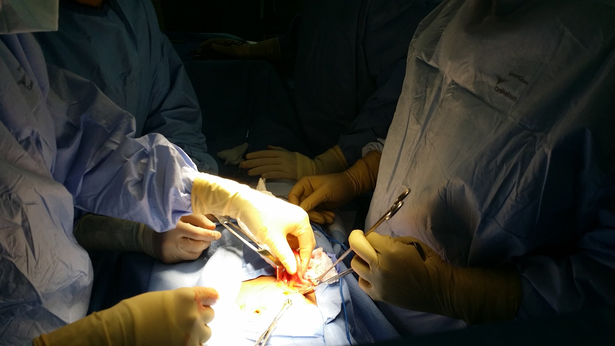 General surgery residents from Hospital Escuela and the surgeon from Joint Task Force-Bravo's Medical Element Mobile Surgical Team (MST) perform a surgical procedure during a Medical Readiness Training Exercise (MEDRETE) in Tegucigalpa, Honduras, July 29-31, 2014. The MST evaluated patients in the emergency department, developed an operating plan, carried out the surgery, and recovered patients all while teaching Honduran surgical residents the process step by step.  (Courtesy Photo)