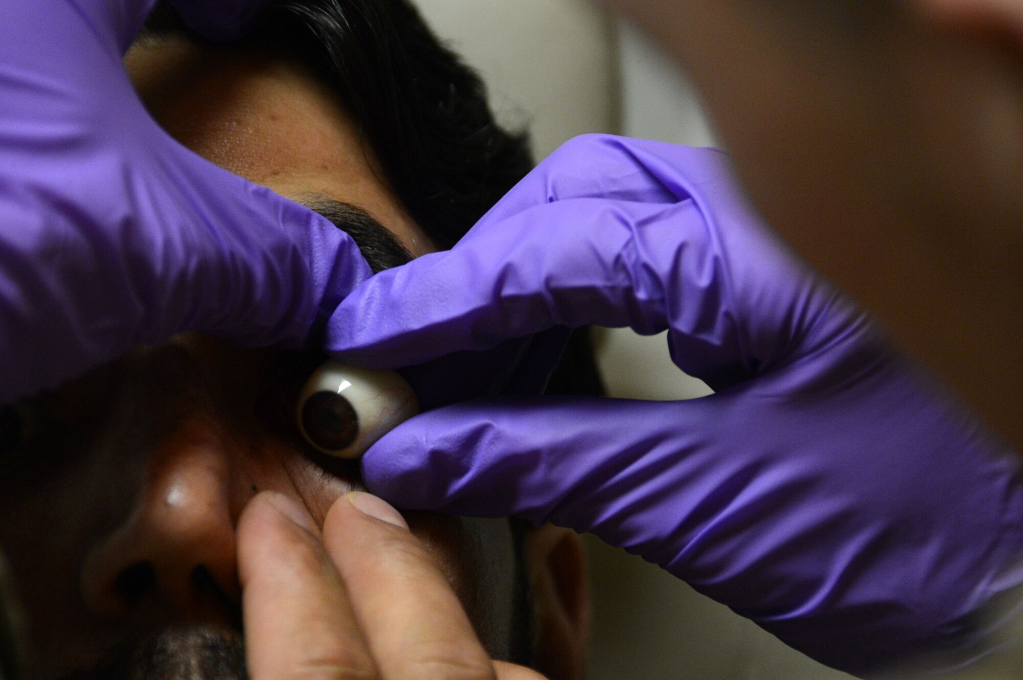 U.S. Air Force Staff Sgt. Vernon Price, a medical technician assigned to the 455th Expeditionary Medical Group, places a prosthetic eye into the left eye socket of an Afghan soldier while at the Craig Joint Theater Hospital at Bagram Airfield, Afghanistan Aug. 7, 2014. The soldier suffered an eye trauma when shrapnel from an explosion hit him four months ago. Price is a native of Goldsborough, N.C. and deployed form the 4th Aerospace Medicine Squadron at Seymour Johnson, Air Force Base, N.C. (U.S. Air Force photo by Master Sgt. Cohen A. Young/Released)