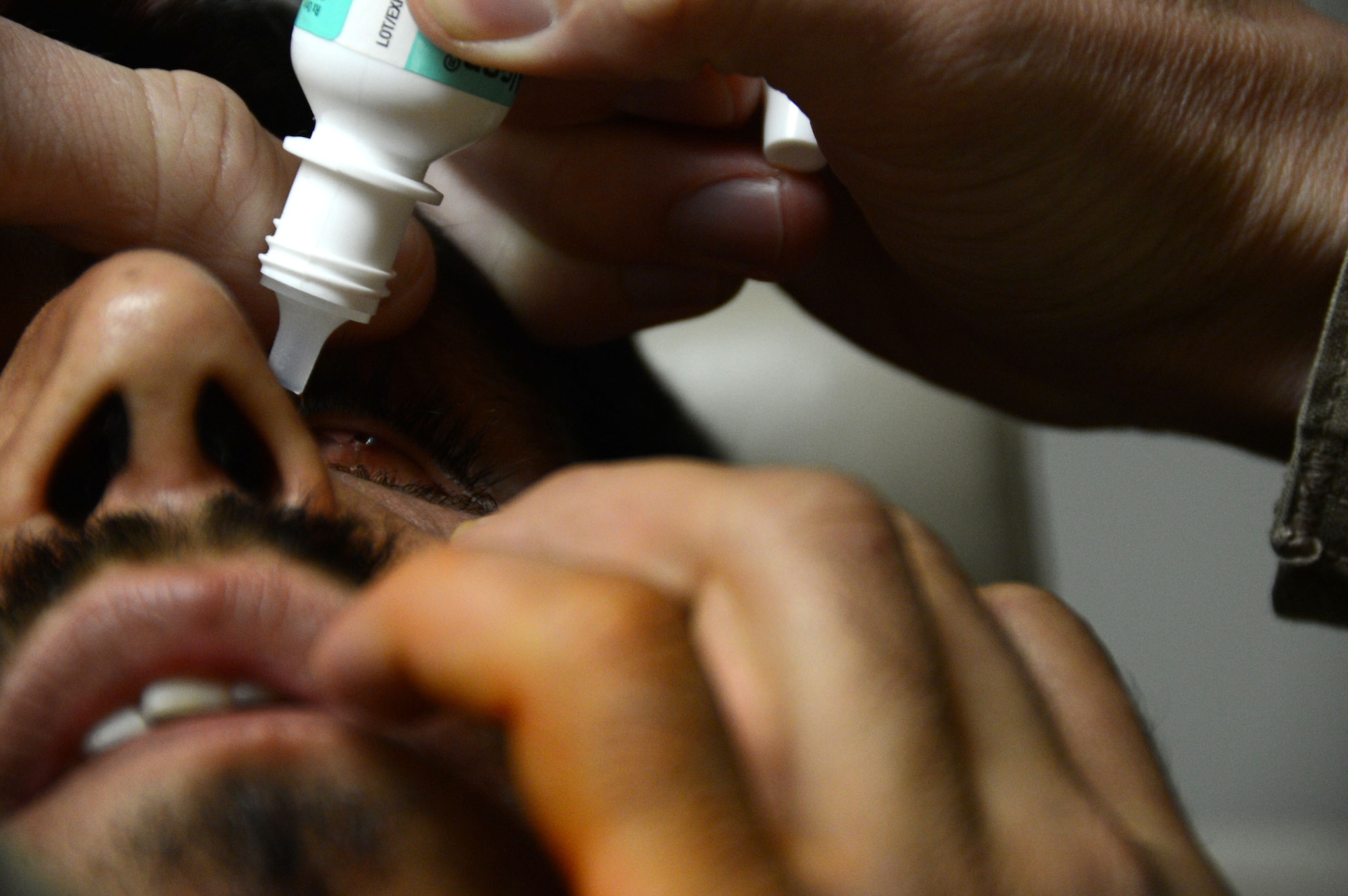 U.S. Air Force Staff Sergeant Vernon Price, a medical technician assigned to the 455th Expeditionary Medical Group, places numbing eye drops in the left-eye socket of an Afghan soldier prior to placing the prosthetic into it while at the Craig Joint Theater Hospital at Bagram Airfield, Afghanistan Aug. 7, 2014. The soldier suffered an eye trauma when shrapnel from an explosion hit him four months ago. Price is a native of Goldsborough, N.C. and deployed form the 4th Aerospace Medicine Squadron at Seymour Johnson Air Force Base, N.C. (U.S. Air Force photo by Master Sgt. Cohen A. Young/Released)