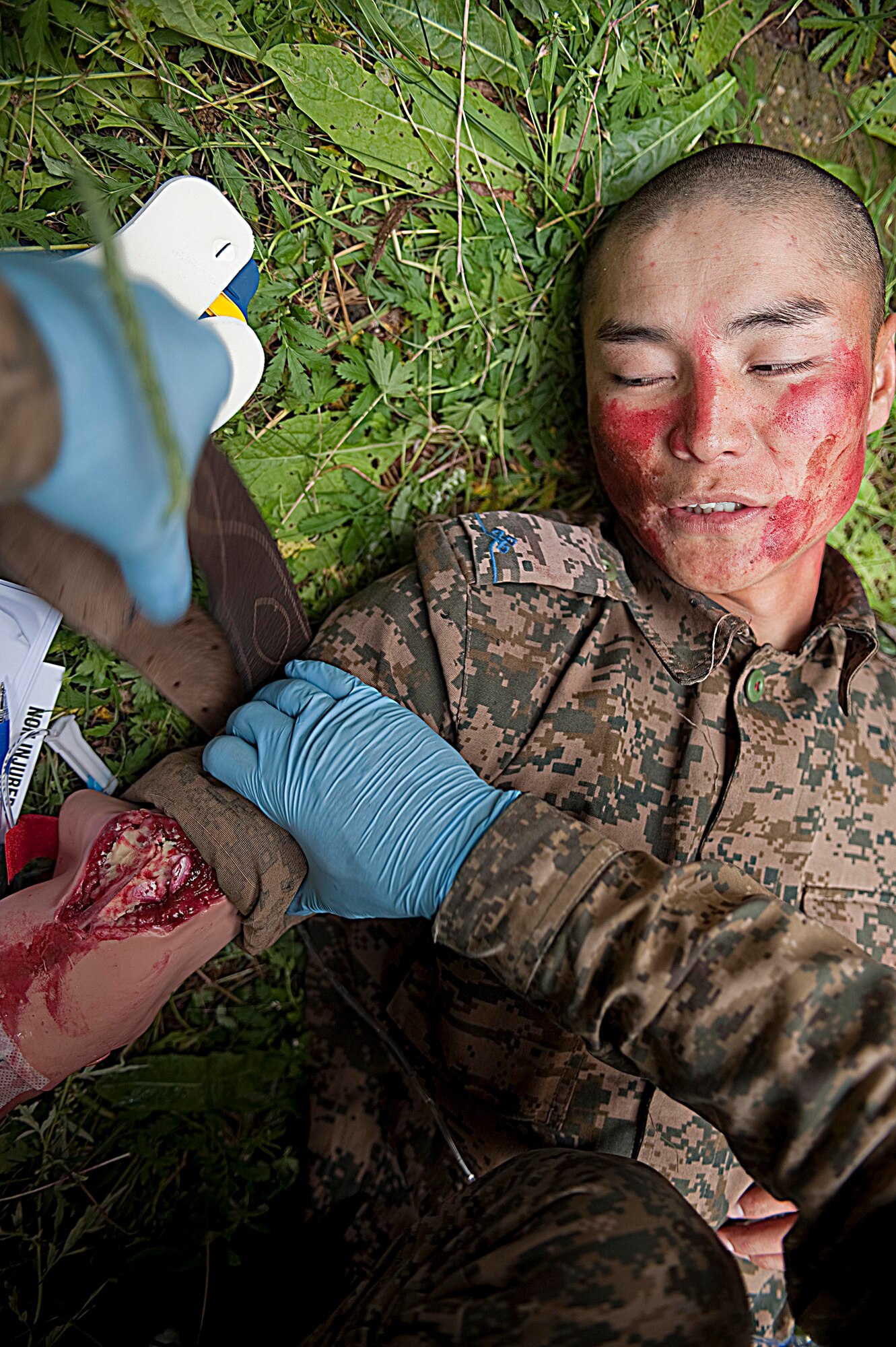 A member of the Mongolian Armed Forces playing a victim during a mass-casualty response exercise as first responders treat his injures, during Operation Pacific Angel 14-4 Mongolia, Aug. 8, 2014. Operation PACANGEL helps cultivate common bonds and fosters goodwill between the U.S., Mongolia and regional nations by conducting multilateral humanitarian assistance and civil military operations. (U.S. Air Force photo by Staff Sgt. William Banton/Released)