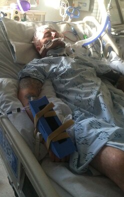 After being in a coma for nearly a month and spending 43 days in the hospital, Hopkins recovery was far from over. He has endured months of grueling physical therapy and had to have his shattered skull hardened with titanium. (Courtesy photo/Hopkins)