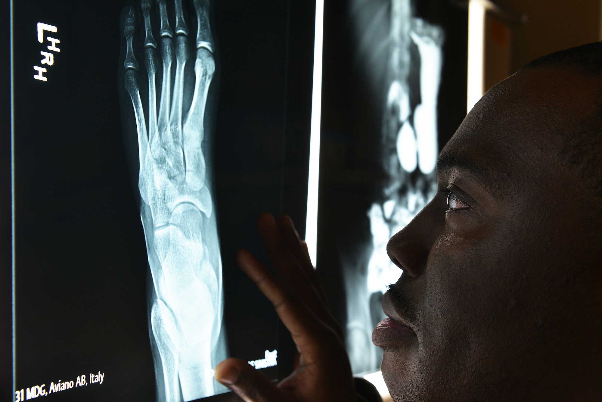 Staff Sgt. Job Stringfellow, 31st Surgical Operations Squadron radiologic technologist, analyzes an x-ray during a training session, Dec. 3, 2014, at Aviano Air Base, Italy. The 31 SGC radiology team is made up of eight enlisted diagnostic technicians and one doctor who specializes using imaging to diagnose and treat diseases seen within the body. (U.S. Air Force photo/Airman 1st Class Ryan Conroy)