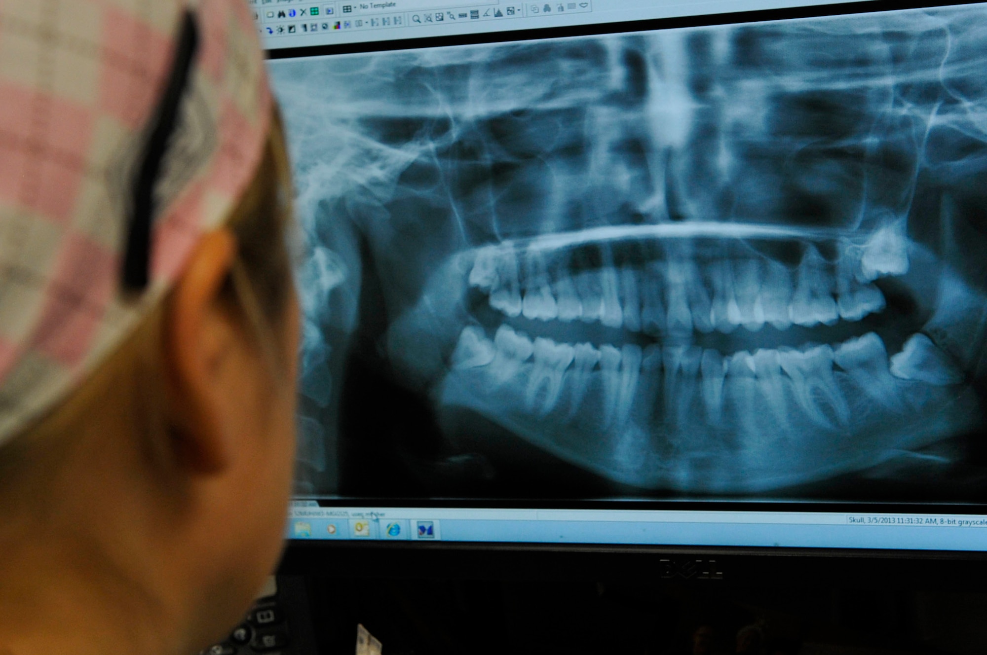 U.S. Air Force Maj. Melissa Fisher, 633rd Medical Group oral and maxillofacial surgeon, reviews a patient’s X-ray before performing oral surgery at Langley Air Force Base, Va., Jan. 2, 2014. In addition to oral surgery, Fisher is also able to perform some cosmetic surgeries. Fisher is a native of Decatur, Ill. (U.S. Air Force photo by Staff Sgt. Wesley Farnsworth/Released)