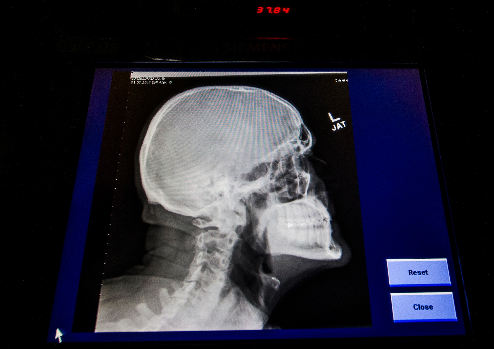 A X-ray is shown at the 376th Expeditionary Medical Group at Transit Center at Manas, Kyrgyzstan, Jan. 08, 2014. X-rays are used to detect bone fractures, find foreign objects in the body and demonstrate the relationship between bone and soft tissue. (U.S. Air Force photo/Senior Airman George Goslin)