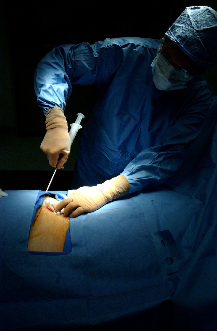 Official U.S. Navy file photo of a surgeon performing a bone marrow harvest operation. The procedure consists of inserting a large-gauge syringe into an area of the hip and extracting the bone marrow. The bone marrow is then transfused into the recipient and helps recreate and replenish T-cells and the white and red blood cells. (U.S. Navy photo by Petty Officer 2nd Class Chad McNeeley/Released)