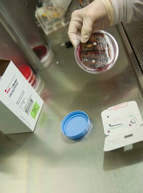 A petri dish is viewed after 18 to 24 hours of growth at Minot Air Force Base, N.D. Jan. 23, 2014.   The petri dish has been swabbed to test for strep throat, an illness that is greatly increased during the winter months. (U.S. Air Force photo/Senior Airman Stephanie Sauberan) 