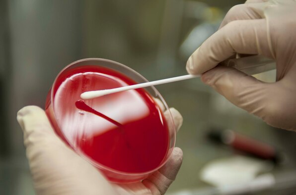 A throat swab is applied to agar in a petri dish to test for Strep throat at Minot Air Force Base, N.D., Jan. 23, 2014. The 5th Medical Group tests for the organism known as “Beta Hemolytic Group A Strep” which is the strain that needs to be diagnosed and treated. (U.S. Air Force photo/Senior Airman Stephanie Sauberan) 