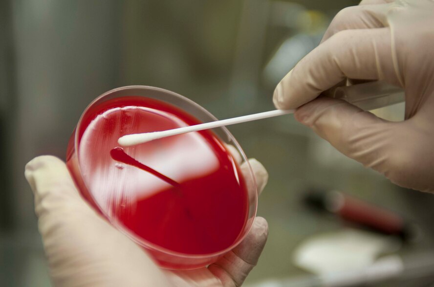 A throat swab is applied to agar in a petri dish to test for Strep throat at Minot Air Force Base, N.D., Jan. 23, 2014. The 5th Medical Group tests for the organism known as “Beta Hemolytic Group A Strep” which is the strain that needs to be diagnosed and treated. (U.S. Air Force photo/Senior Airman Stephanie Sauberan) 