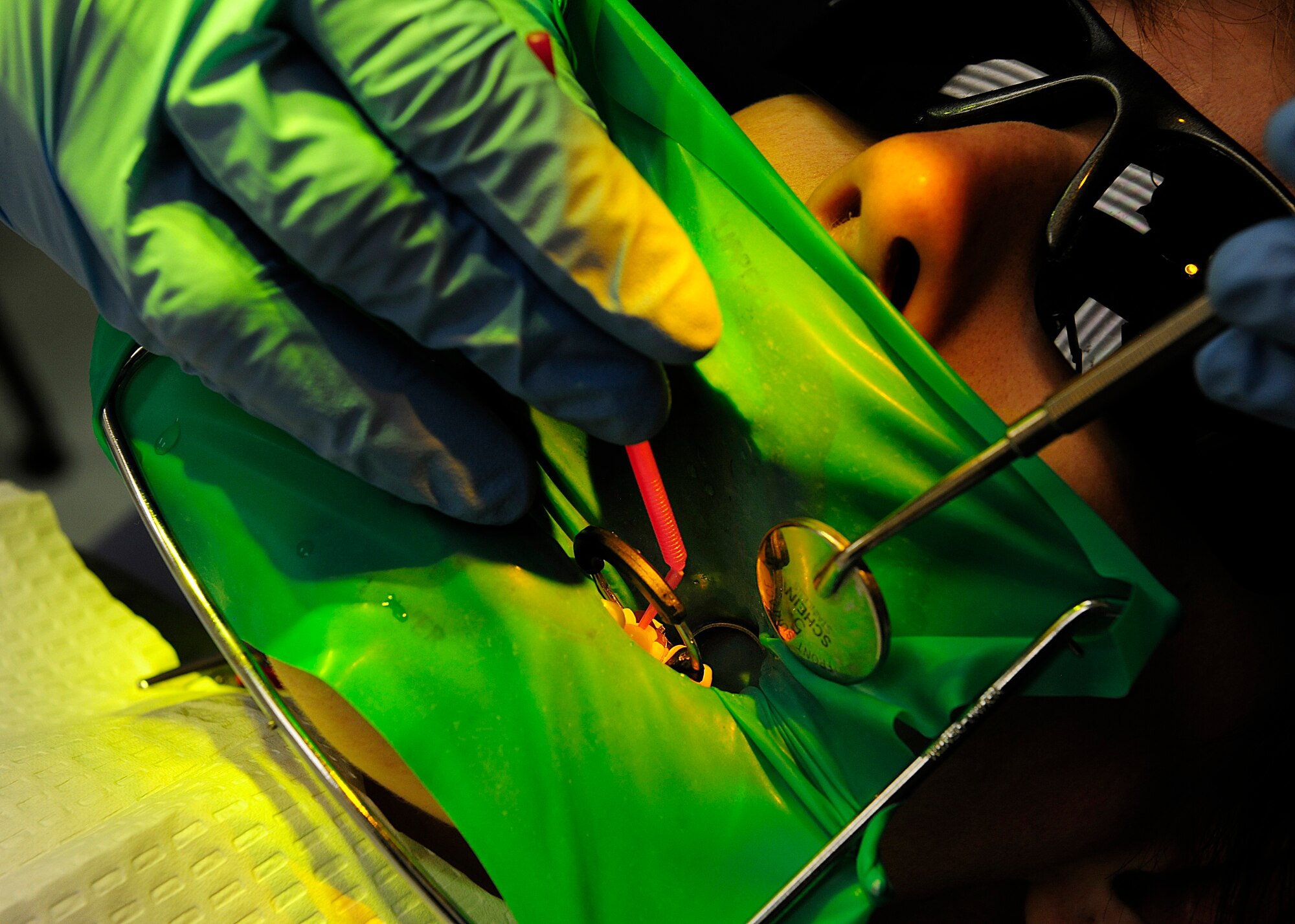 Senior Airman Patricia Gregg, 724th Air Mobility Squadron, receives a routine cleaning during an annual checkup, June 19, 2014, at Aviano Air Base, Italy.  The 31st Dental Squadron keeps Airmen healthy through a proactive approach that includes annual checkups, dental cleanings, educating patients on healthy habits and techniques for daily care and preventative restorations. (U.S. Air Force photo/Airman 1st Class Ryan Conroy) 