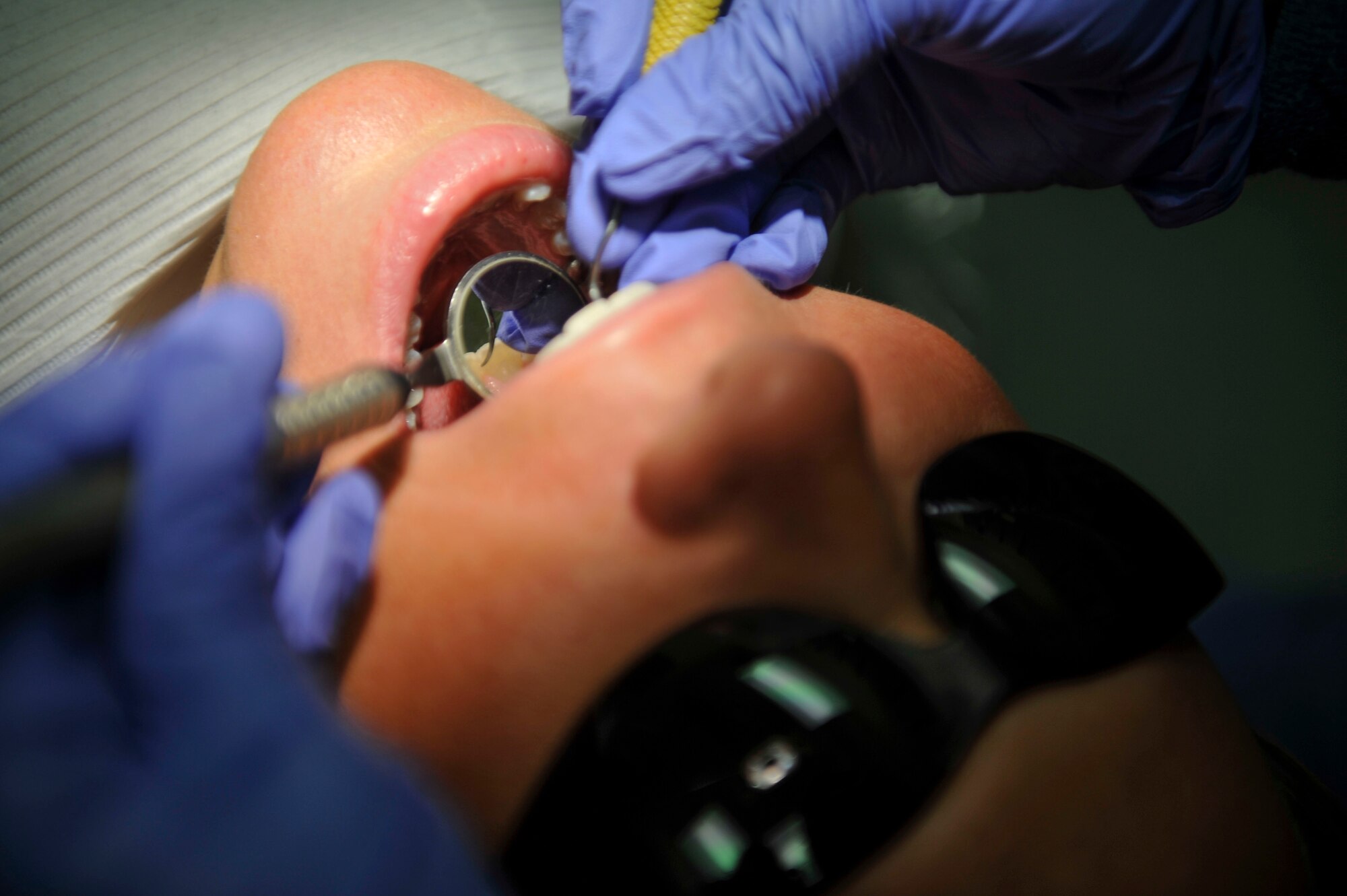 Staff Sgt. Janice Gonzales, 51st Dental Squadron prophylaxis technician, uses a dental explorer to check for the presence of tooth decay on the teeth of Senior Master Sgt. Kathleen Ross, 51st Security Forces Squadron first sergeant, during her annual dental examination on Osan Air Base, Republic of Korea, July 16, 2014. The 51st DS provides care for more than 5,000 patients annually. (U.S. Air Force photo by Senior Airman David Owsianka)