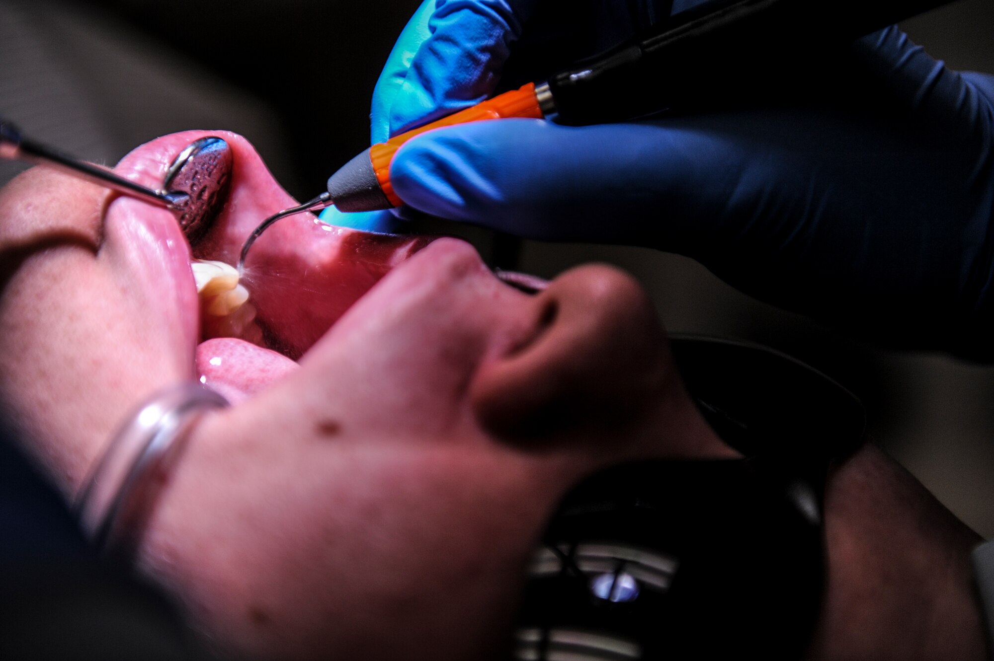 An Airman from the19th Medical Group dental clinic cleans, Airman 1st Class Jacob Burgener, a 53rd Airlift Squadron crew chief, teeth July 10, 2014, at Little Rock Air Force Base, Ark. The 19th MDG provides care to more than 6,000 Airmen and families on Little Rock AFB. (U.S. Air Force photo by Airman 1st Class Cliffton Dolezal)