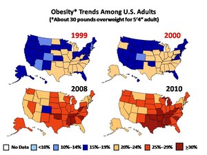 Obesity has been steadily rising since the turn of the millennium, and has yet to decline. Currently, more than a third of all Americans are clinically obese, largely due to poor diets, according to the Centers for Disease Control and Prevention. (photo courtesy of CDC)