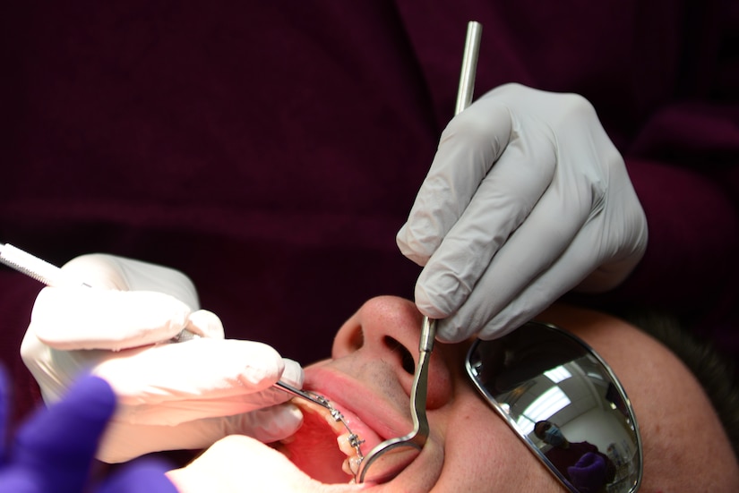 U.S. Air Force Capt. Julie Anderson, 633rd Dental Squadron Advanced Educational General Dentistry resident, adjusts a patient’s braces during training at Langley Air Force Base, Va., March 13, 2014. After completing medical school and Air Force Officer Training School, a select few new Air Force dentists are given the opportunity to become a resident at up to ten different assignments. Anderson hails from Florence, Ky. (U.S Air Force photo by Airman 1st Class Kimberly/Released) 