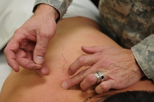 Acupuncture treatment is administered to a patient by the Physical Medicine and Integrative Health Services chief, at Fort Bliss, Texas.