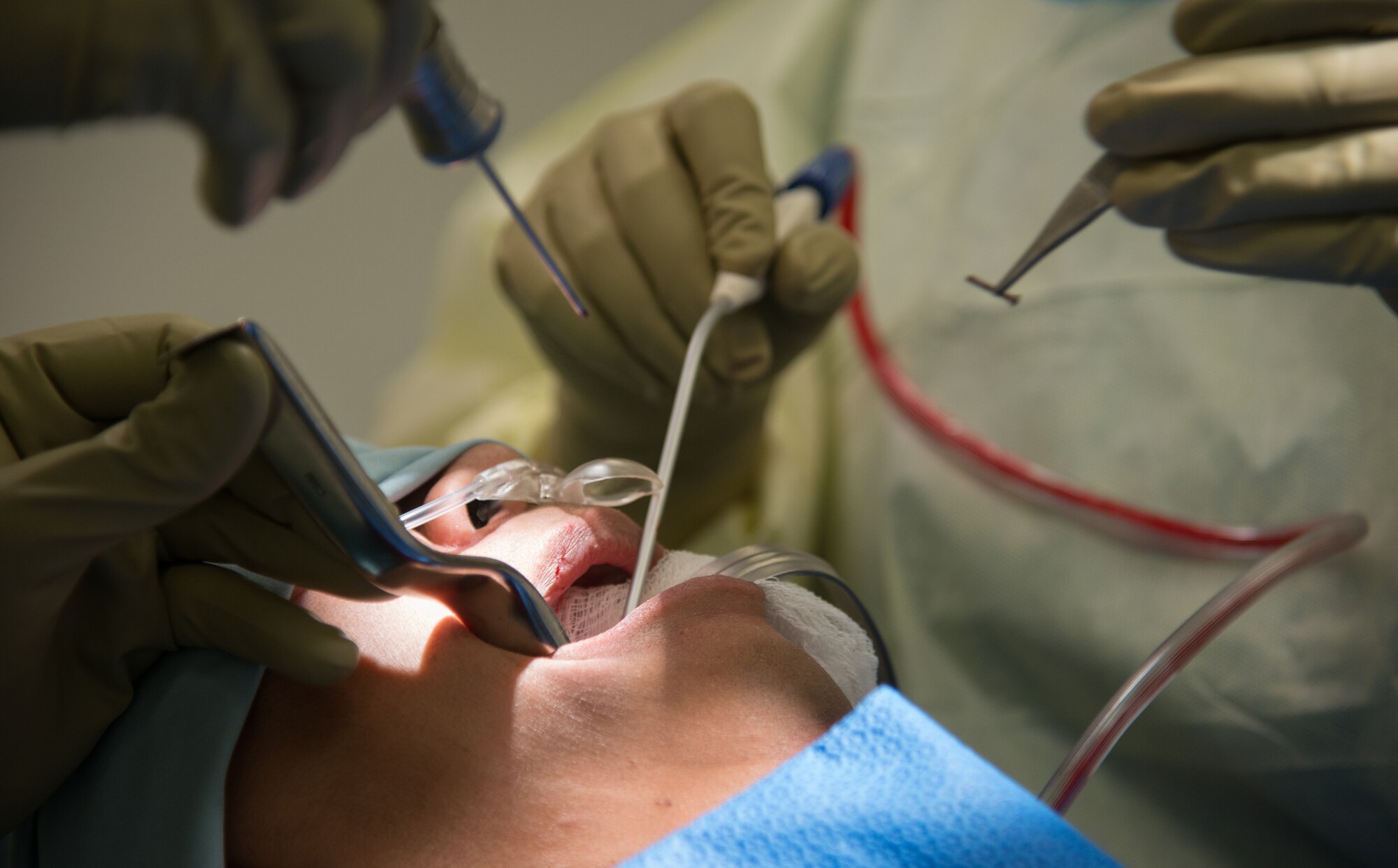 A screw is taken out of a patient during a dental implant surgery at Ramstein Air Base, Germany, April 29, 2014. Performing dental implants is a routine operation for Airmen like Maj. Curtis Hayes, 86th Dental Squadron chief oral and maxillofacial surgeon, who was named Air Force Dentist of the Year for his outstanding accomplishments. (U.S. Air force photo/Senior Airman Jonathan Stefanko)