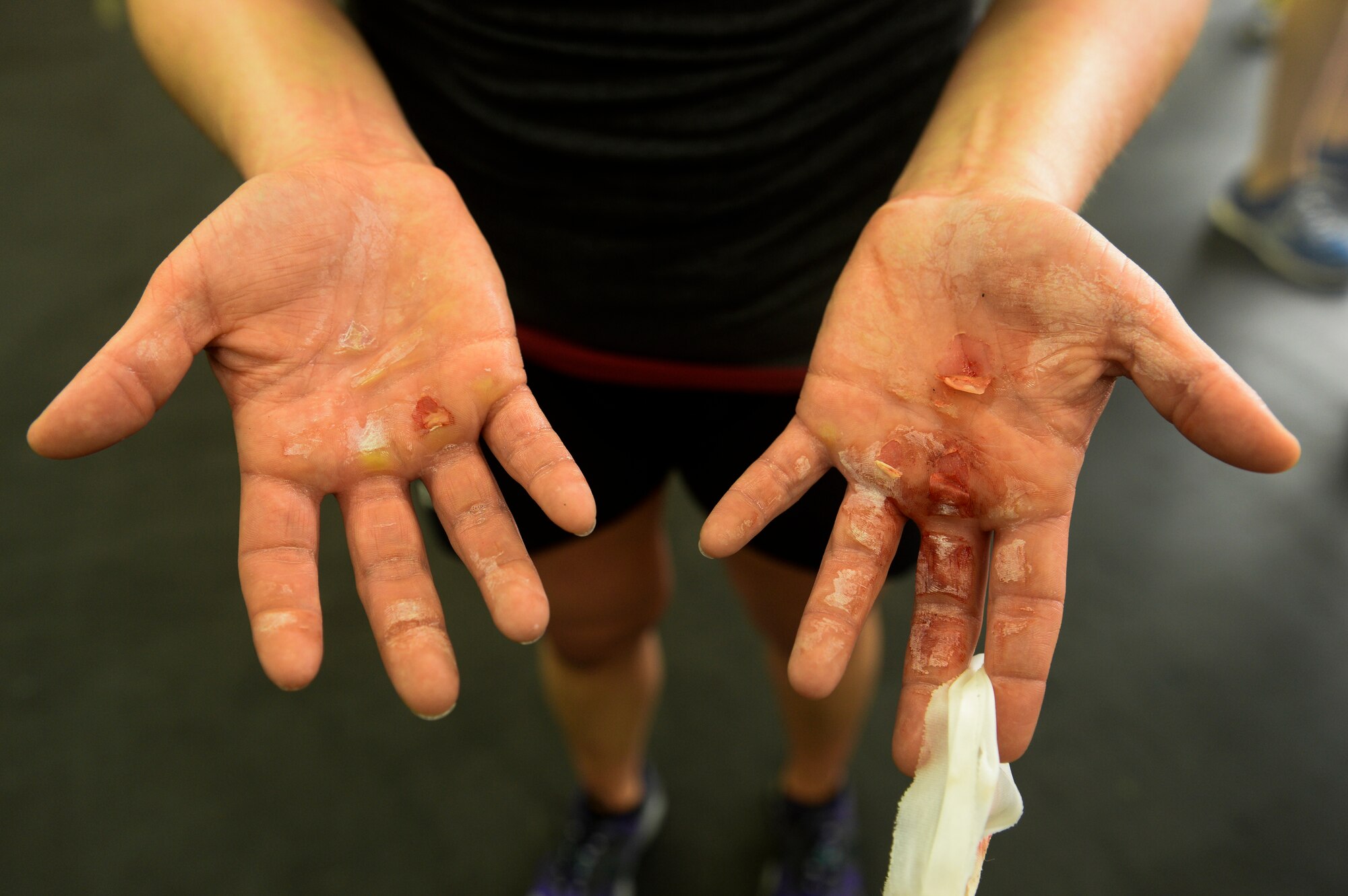 Spangdahlem Airman displays her hands after completing a “Murph” Challenge at Spangdahlem Air Base, Germany. The event is held annually to memorialize the actions of U.S. Navy Lt. Michael Murphy and all fallen heroes. (U.S. Air Force photo by Senior Airman Rusty Frank/Released)
