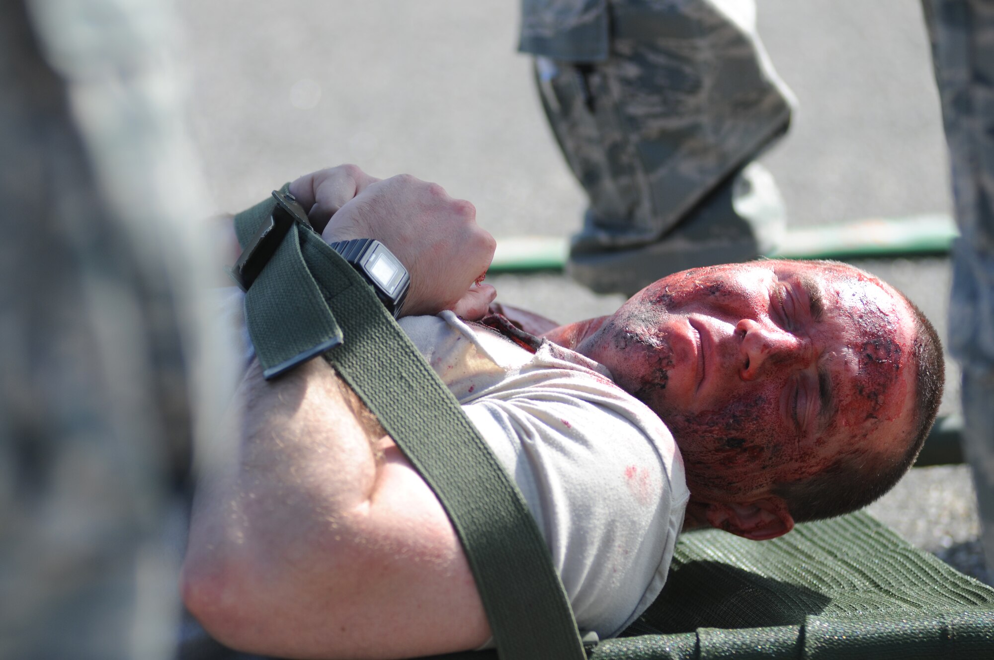 Senior Airman Willie Moore, 81st Logistics Readiness Squadron forklift operator, lays on a stretcher to be transported to the Keesler Medical Center during a hazardous material exercise scenario Nov. 5, 2014, at the Taylor Logistics Center, Keesler Air Force Base, Miss.  The exercise scenario began with an Airman accidentally hitting a 55-gallon drum of sulfuric acid with a forklift and knocking several more drums off of a truck causing the liquid to splash onto other Airmen.  Immediately, the Airmen simulated skin and eye burns from exposure to the agent, while additional Airmen on the loading dock started coughing and experiencing shortness of breath. Moore was the simulated driver of the forklift. (U.S. Air Force photo by Kemberly Groue)