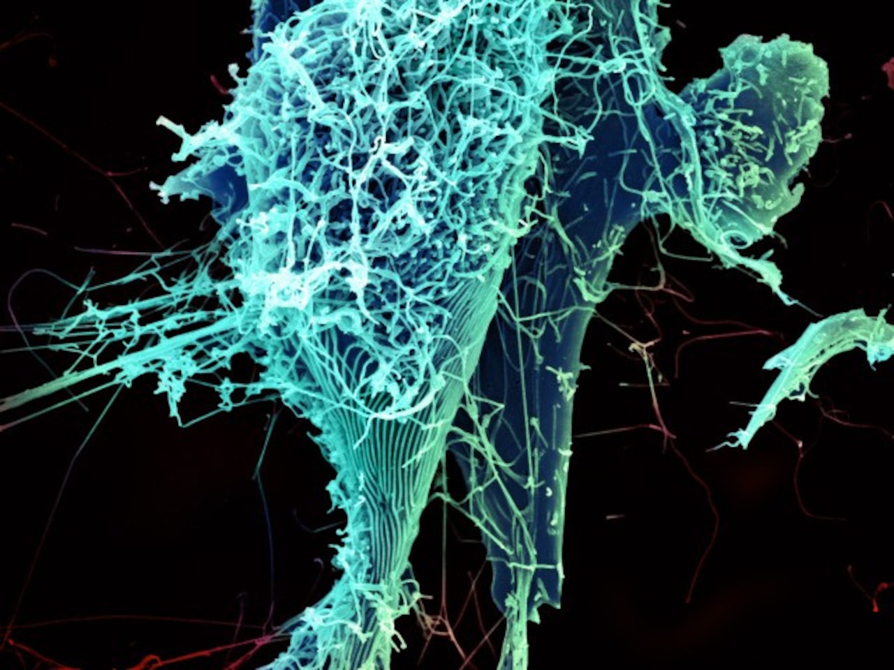 String-like Ebola virus particles shed from an infected cell in this electron micrograph. National Institute of Allergy and Infectious Diseases photo