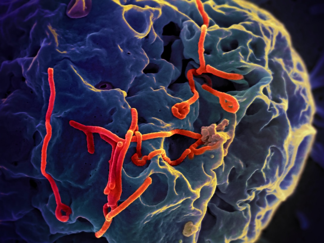 This scanning electron micrograph shows Ebola virus budding from the surface of a Vero cell from the African green-monkey kidney epithelial cell line. National Institute of Allergy and Infectious Diseases photo