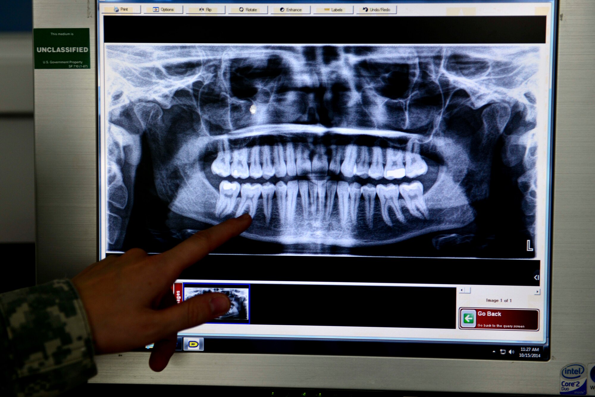 U.S. Army Capt. Elsie Hinz, Dental Command officer-in-charge examines a panoramic X-ray at Fort Eustis, Va., Oct. 15, 2014. The panoramic X-ray gives dentists a look at the entire mouth to help find any issues, such as problems in the tooth root. (U.S. Air Force photo by Airman 1st Class Kimberly Nagle/Released)