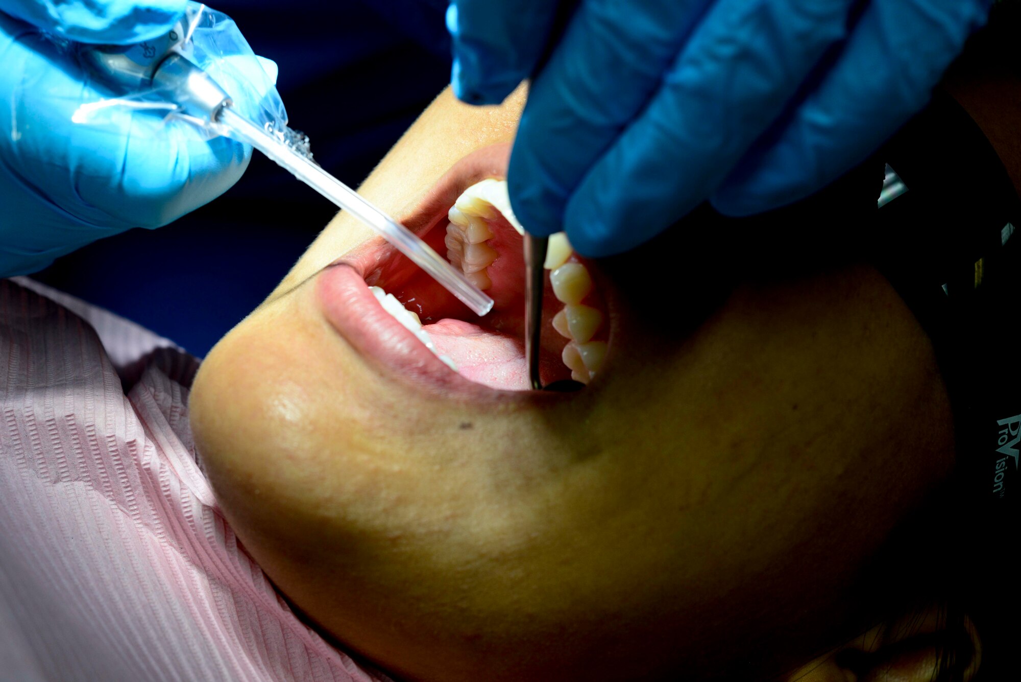A patient in the Dental Command receives a cleaning at Fort Eustis, Va., Oct. 15, 2014. During the cleaning, the patient received multiple tips to keep their teeth healthy, such as proper flossing and brushing techniques. (U.S. Air Force photo by Airman 1st Class Kimberly Nagle/Released)