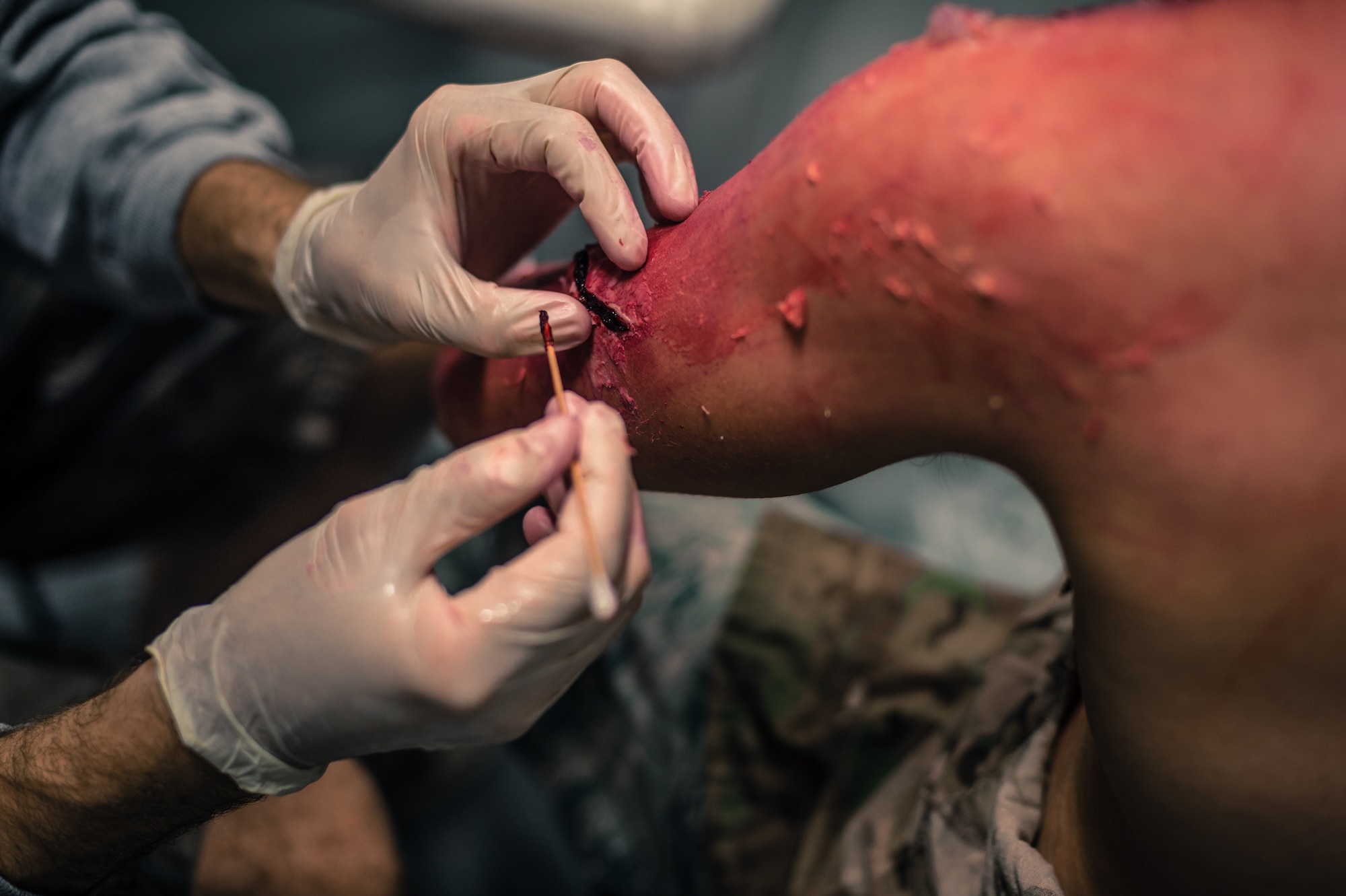 Airman 1st Class Thomas Boburka, 86th Ammunitions Squadron storage crew member, has a cosmetic wound applied to his arm by Capt. Nate Larson, 86th Dental Squadron dentist, as part of a major accident response exercise on Ramstein Air Base, Germany, Oct. 18, 2014. Members of the Air Force and host nation agencies partnered in conducting a response and recovery in preparation for possible real-world incidents. (U.S. Air Force photo/Airman 1st Class Jordan Castelan)
