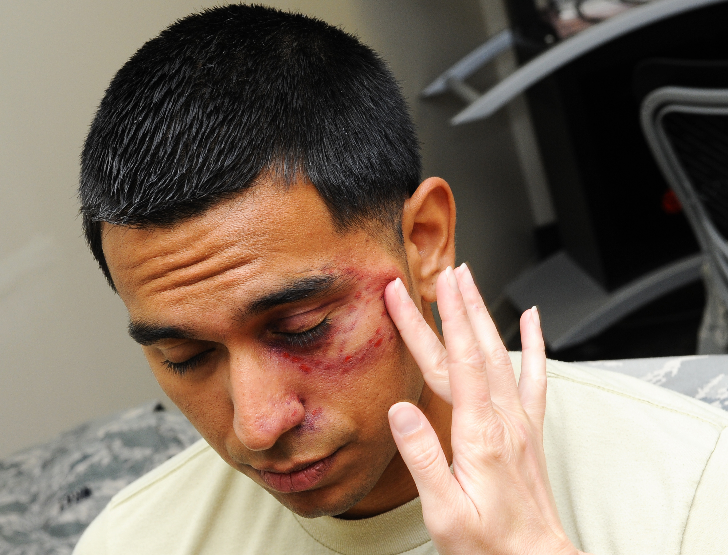Black Eye Campaign Highlights Hidden Hurt Air Force Special