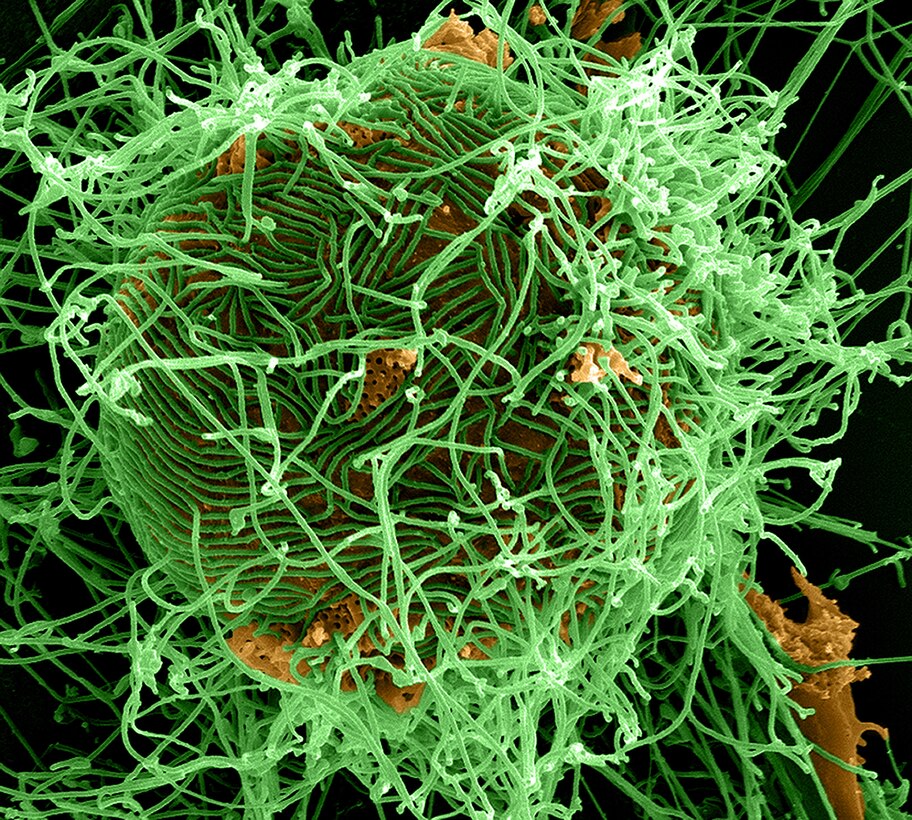 A digitally colorized scanning electron micrograph depicts numerous filamentous Ebola virus particles in green, budding from a chronically infected VERO E6 cell in orange at 25,000X magnification. National Institute of Allergy and Infectious Diseases photo