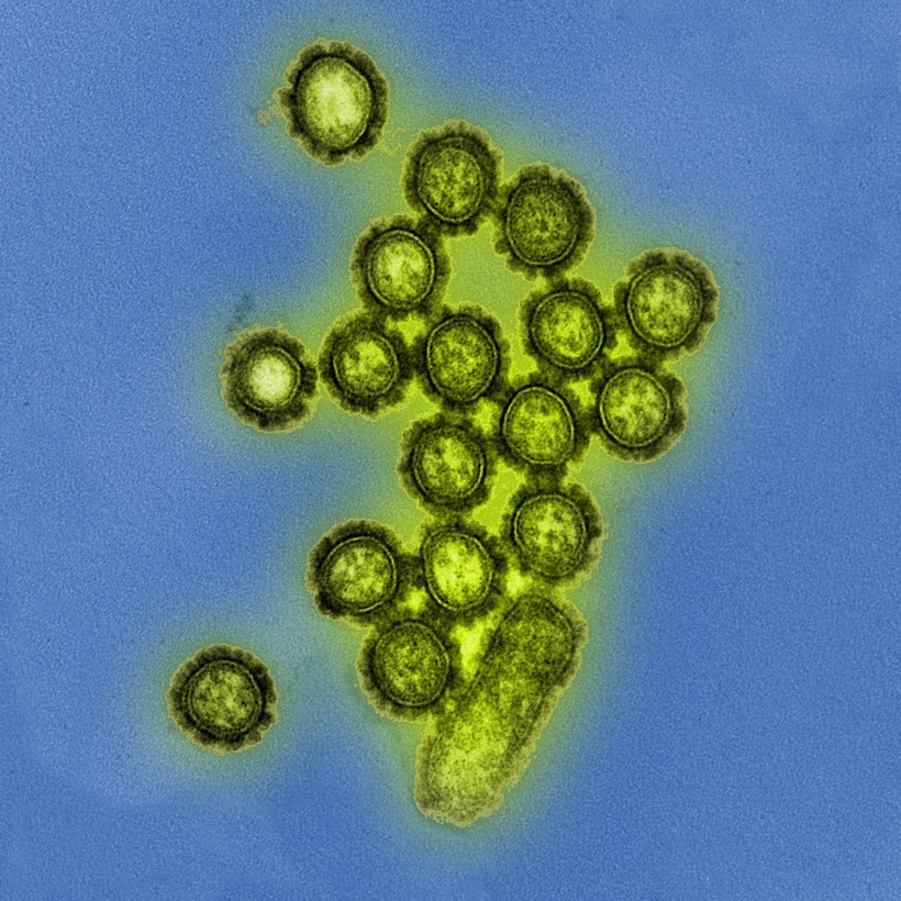 A colorized transmission electron micrograph shows H1N1 influenza virus particles. Surface proteins on the virus particles, which are targeted by flu vaccines, are shown in black. National Institute of Allergy and Infectious Diseases photo