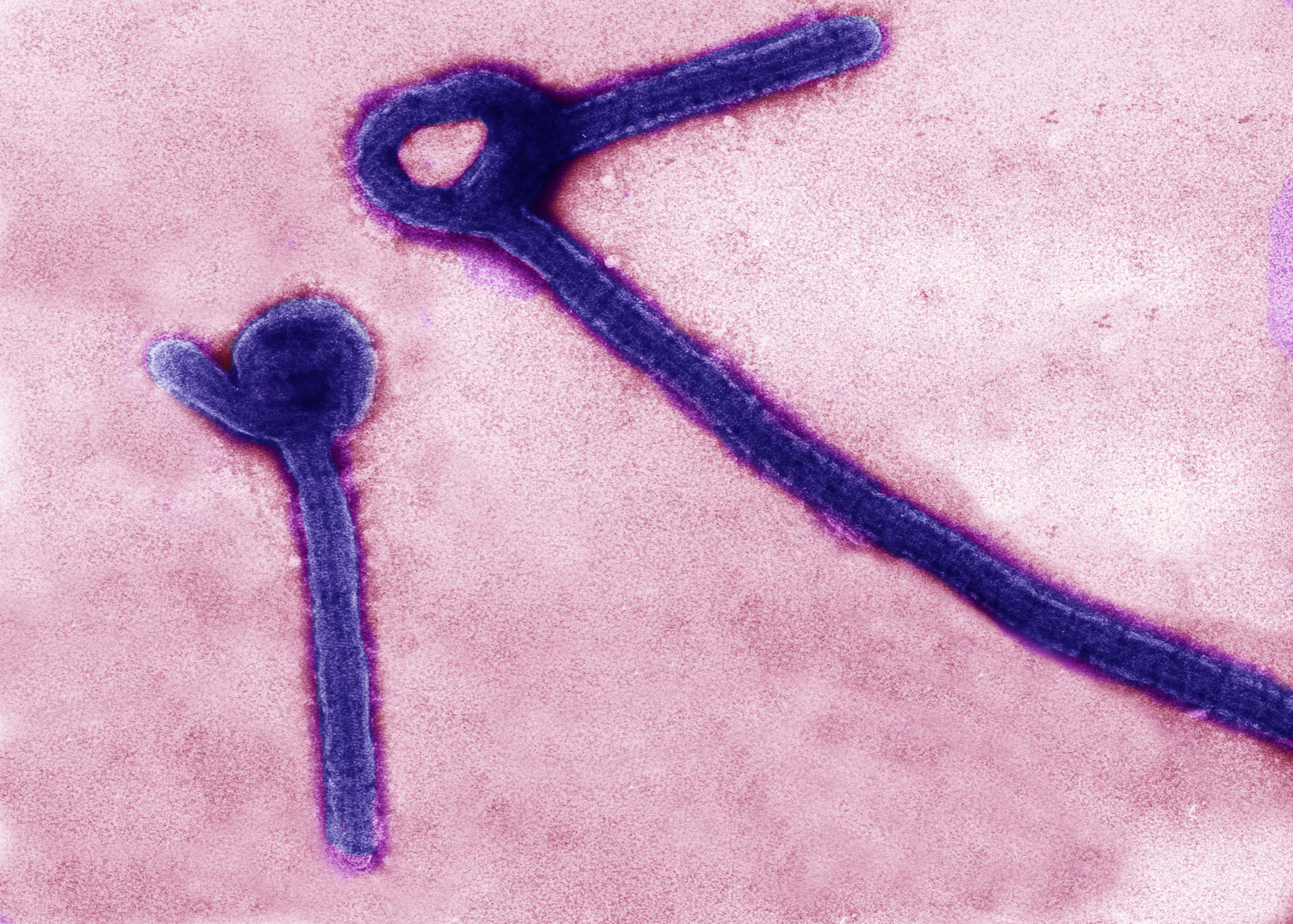 A transmission electron micrograph shows Ebola virus particles. U.S