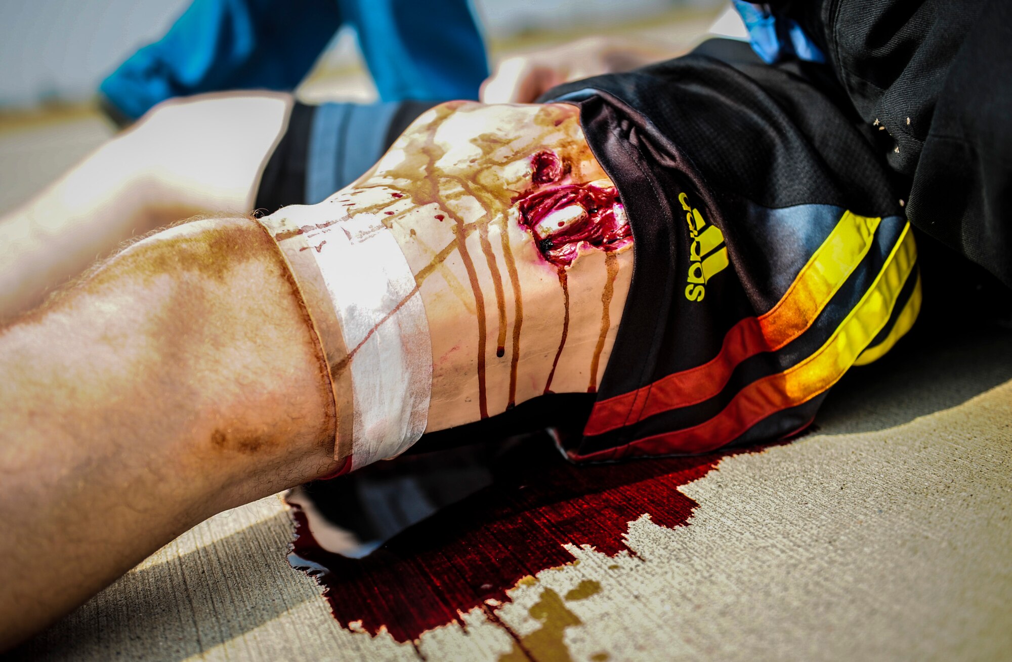 A simulated patient bleeds out during a local readiness exercise Aug. 28, 2014, Incirlik Air Base, Turkey. Medical Airmen along with other first responders simulated a possible real world situation responding to multiple patients as quickly as possible. (U.S. Air Force photo by Senior Airman Nicole Sikorski/Released)
