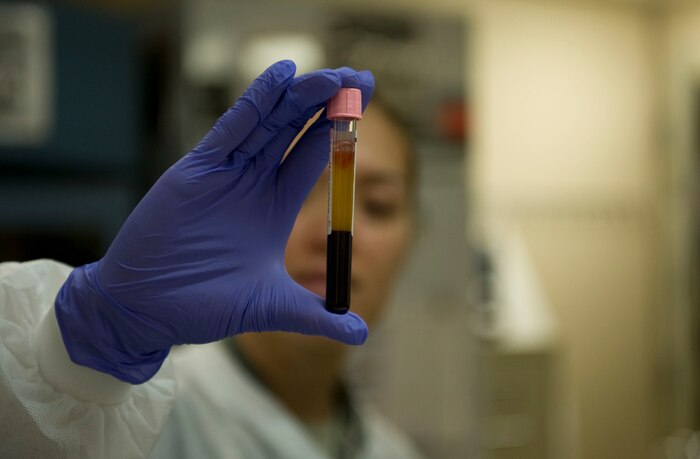 Staff Sgt. Aisuluu Alford, 99th Medical Support Squadron NCO in charge of transfusion services, observes a blood sample at the Mike O’Callaghan Federal Medical Center at Nellis Air Force Base, Nev., Sept. 16, 2014. By being able to perform a wide variety of tests, the laboratory is able to give health-care providers an insight into a patient’s medical condition. (U.S. Air Force photo by Airman 1st Class Thomas Spangler)