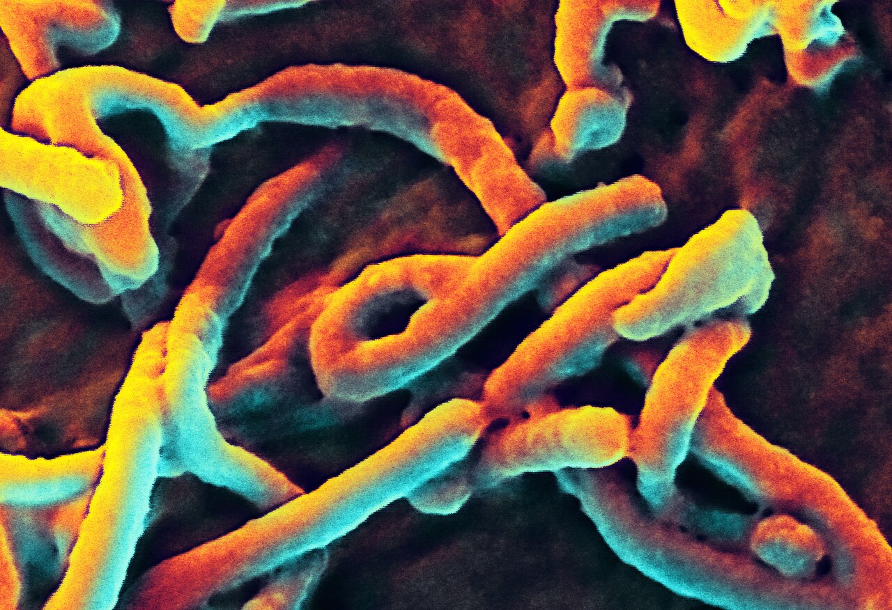 This is a scanning electron micrograph of an Ebola virus budding from the surface of a Vero cell from the African green monkey kidney epithelial cell line. National Institute of Allergy and Infectious Disease photo