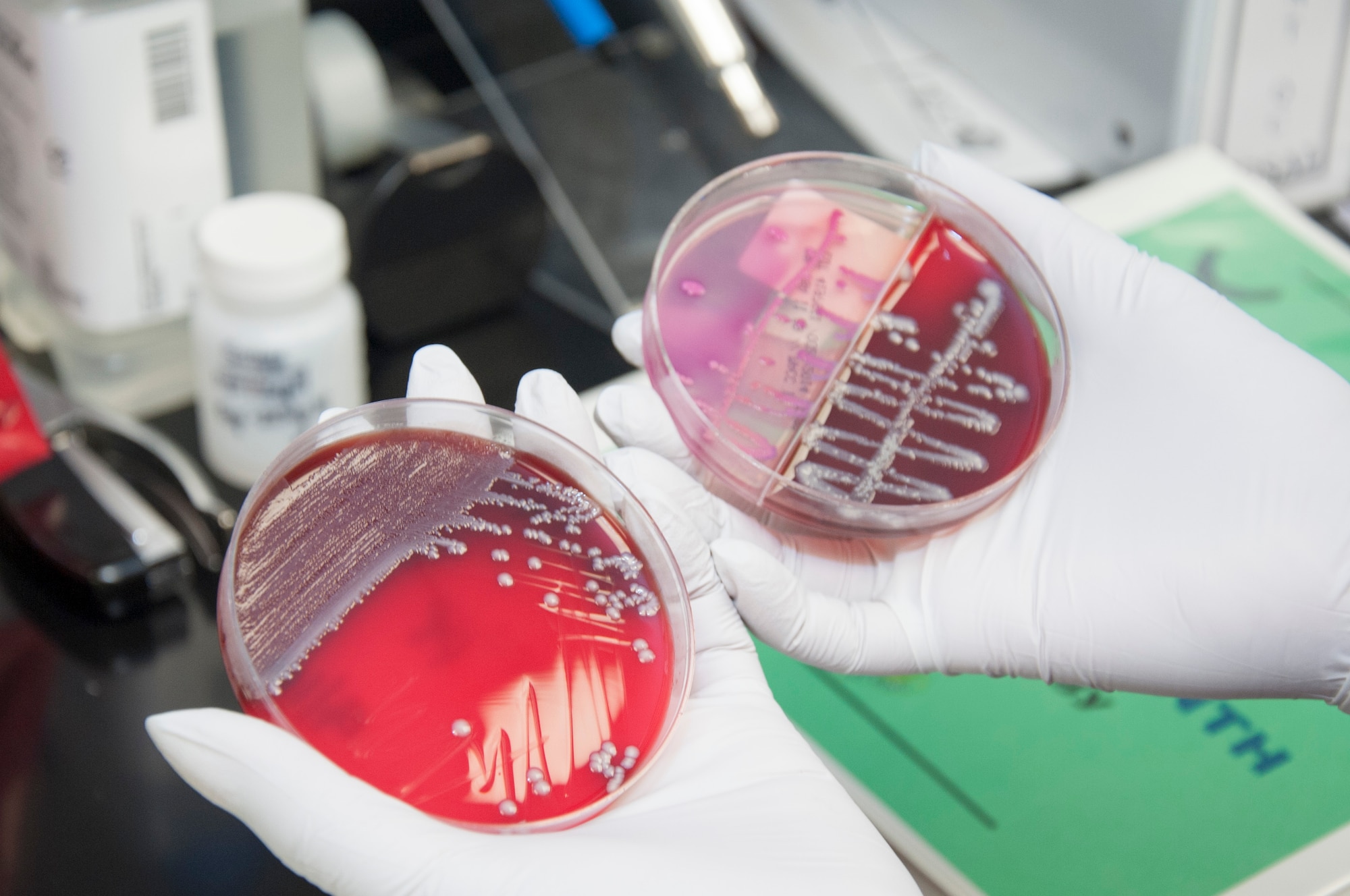 A medical laboratory technician holds cultures of urine Sept. 19, 2014, at the medical treatment facility on Dover Air Force Base, Del. Microbiology draws cultures from wounds, urine and the throat lining and grows the samples to identify what kind of bacteria is causing the infection. (U.S. Air Force photo/Senior Airman Jared Duhon)