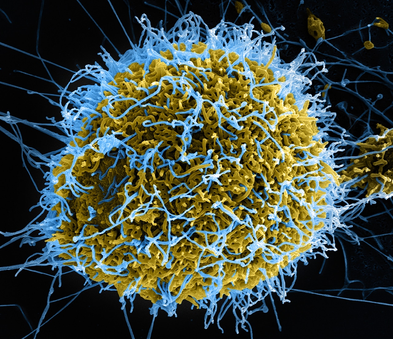 This is a colorized scanning electron micrograph of filament-like Ebola virus particles, in blue, budding from a chronically infected kidney Vero E6 cell, in yellow-green. National Institute of Allergy and Infectious Disease photo