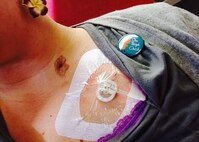 Staff Sgt. Amanda Dick receives chemotherapy through her port during her first chemo treatment, Jan. 15, 2014, at Tripler Army Medical Center, Hawaii. Dick began chemotherapy as treatment for breast cancer, finishing May 2014. (Courtesy photo)