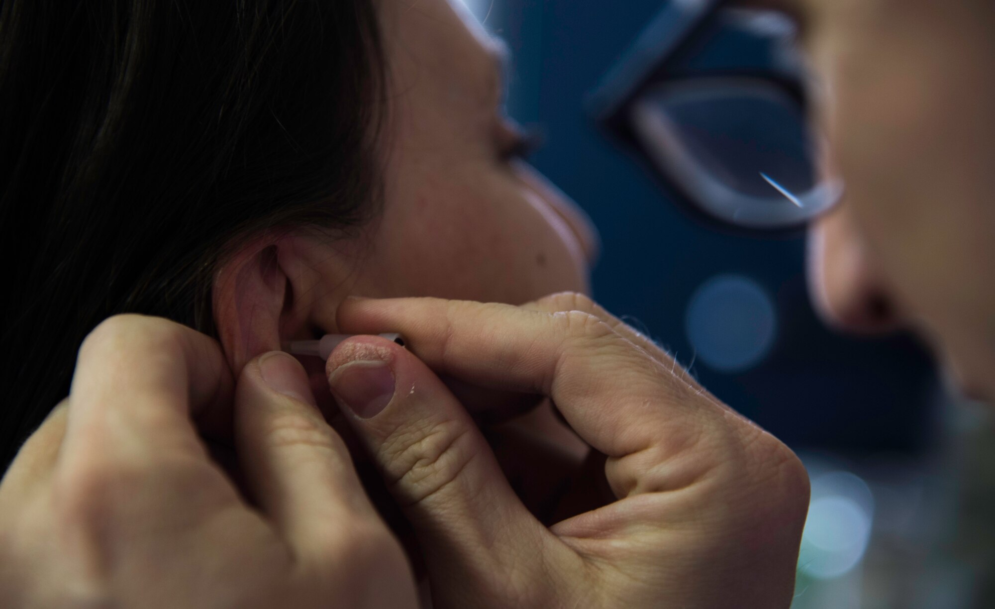 Jennifer Whitaker, acupuncture patient, receives a needle in her ear during an acupuncture treatment session at the Malcom Grow Medical Clinics and Surgery Center, Joint Base Andrews, Md., April 15, 2015. The Air Force has a new initiative to complement western medicine with acupuncture care for service men and women in accordance with the May 2010 Pain Management Task Force objective. (U.S. Air Force photo/Airman 1st Class Philip Bryant)