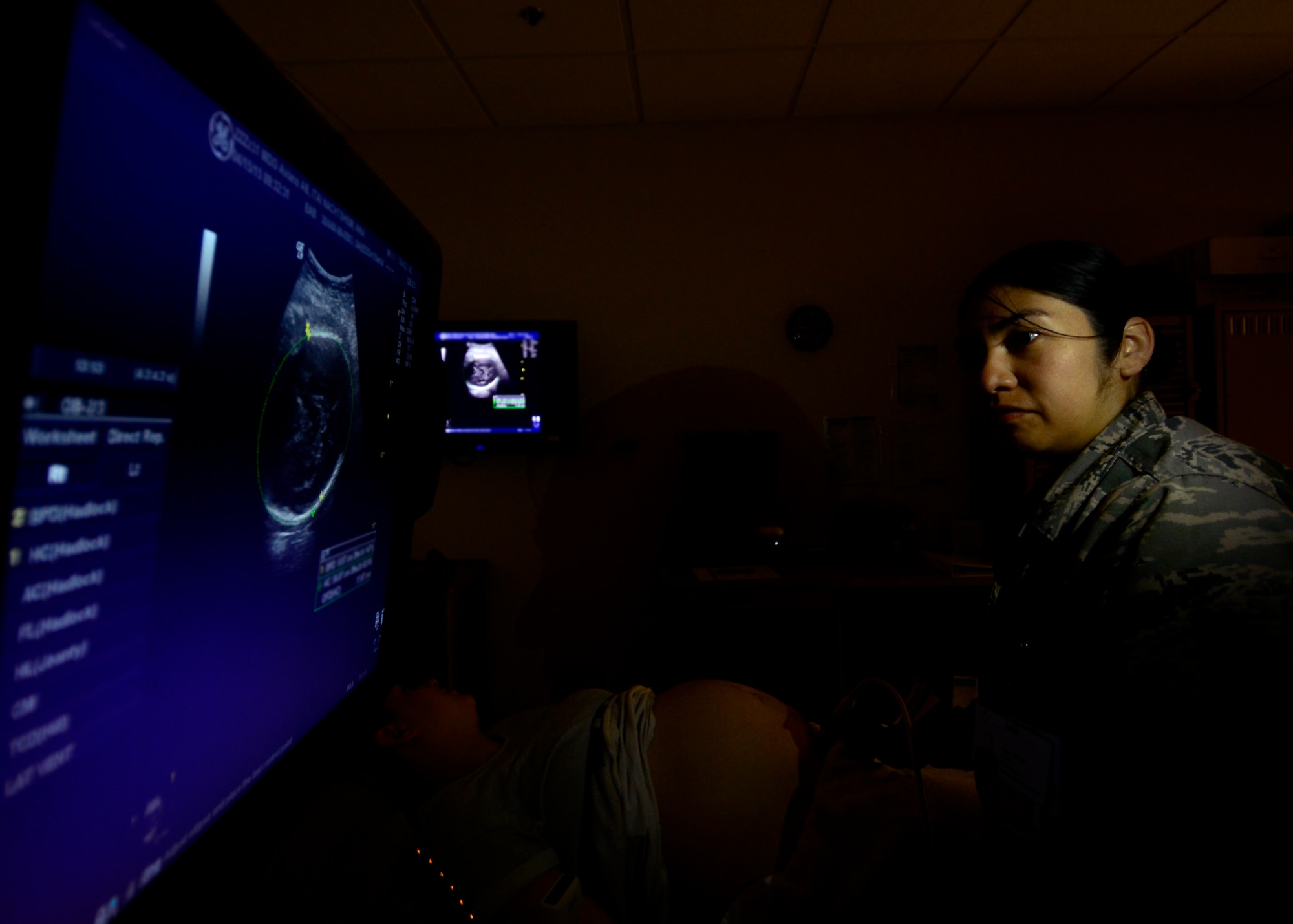 U.S. Air Force Staff Sgt. Evelyn Baxter, 31st Surgical Operations Squadron ultra sound noncommissioned officer in charge, performs an ultrasound on a patient, April 15, 2015, at Aviano Air Base, Italy. During an ultrasound, a transducer is moved over parts of the body to create images from sound waves. (U.S. Air Force photo by Senior Airman Areca T. Wilson/Released)