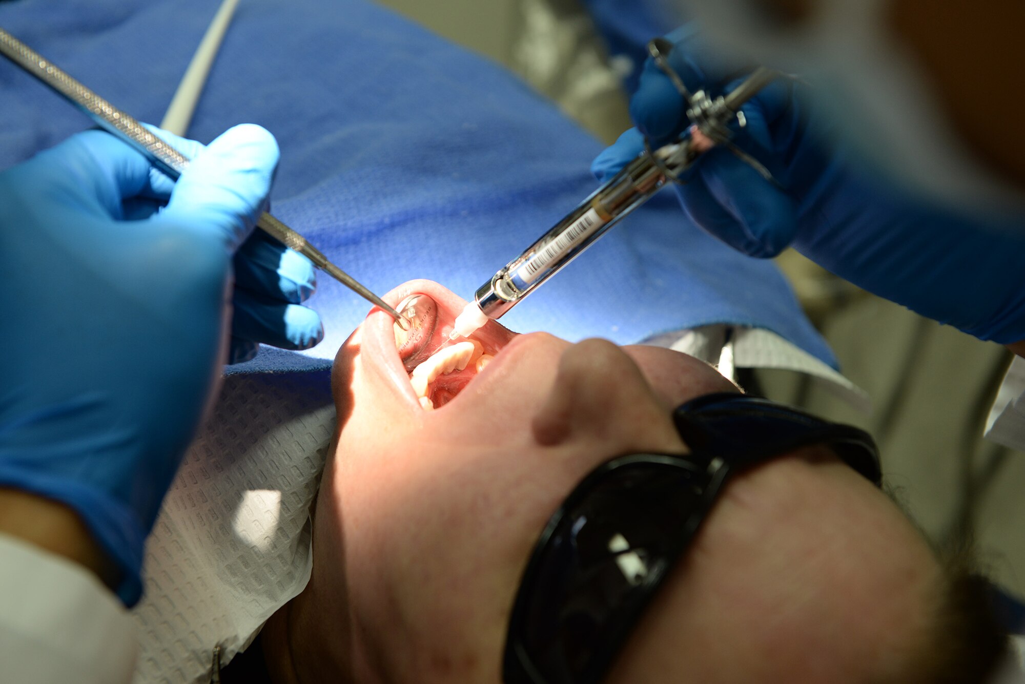 A patient receives anesthetic in preparation for root-end dental surgery April 16, 2015 at Yokota Air Base, Japan. Root-end surgery involves lifting the gums away to access the root of the patient’s teeth, after which the gums are carefully sewn back in to place. (U.S. Air Force photo by Airman 1st Class Elizabeth Baker/Released)