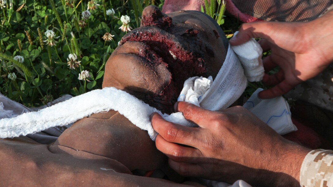 Pfc. Kevin J. Oronaponce, a rifleman with 2nd Battalion, 2nd Marine Regiment, 2nd Marine Division, wraps a facial wound on a mannequin during the final test for the Combat Trauma Care Course aboard Marine Corps Base Camp Lejeune, North Carolina, April 24, 2015. The additional stress from interactive mannequins and working under a time limit for the evacuation provided a more realistic environment to better prepare the Marines in case they would be called upon to use these techniques in real life. (U.S. Marine Corps photo by Pfc. David N. Hersey)