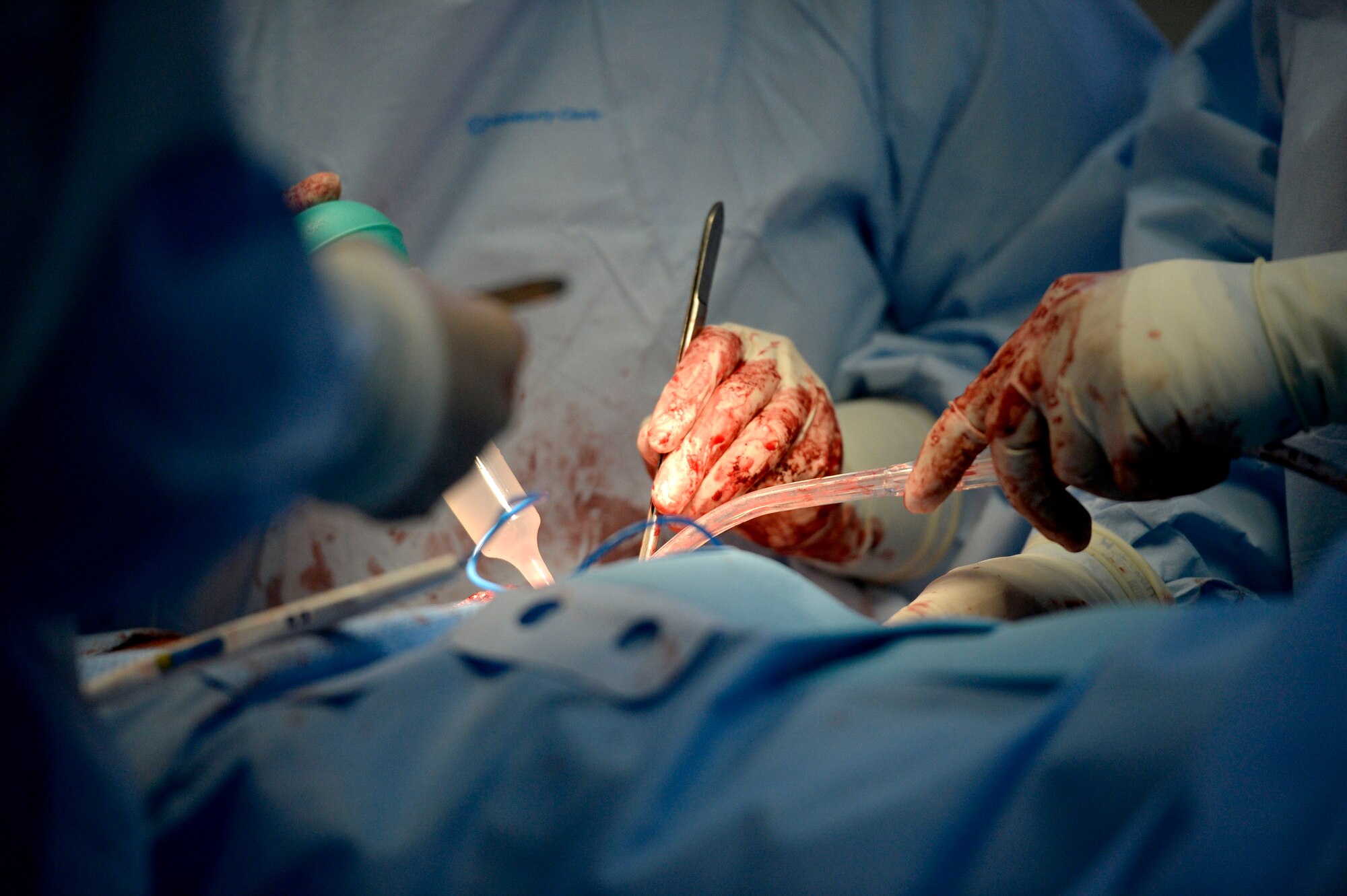 U.S. Air Force medical personnel work hand in hand with Honduran doctors to perform an emergency surgical procedure on a Honduran Army soldier with the 15th Battalion at the Dr. Salvador Paredes Hospital, August 10, 2015. The Honduran solider was one of 13 involved in an explosion at his base. The medical personnel are in Honduras as part of the New Horizons Honduras 2015 training exercise. 

New Horizons was launched in the 1980s and is an annual joint humanitarian assistance exercise that U.S. Southern Command conducts with a partner nation in Central America, South America or the Caribbean. The exercise improves joint training readiness of U.S. and partner nation civil engineers, medical professionals and support personnel through humanitarian assistance activities.

(U.S. Air Force photo by Capt. David J. Murphy/Released)