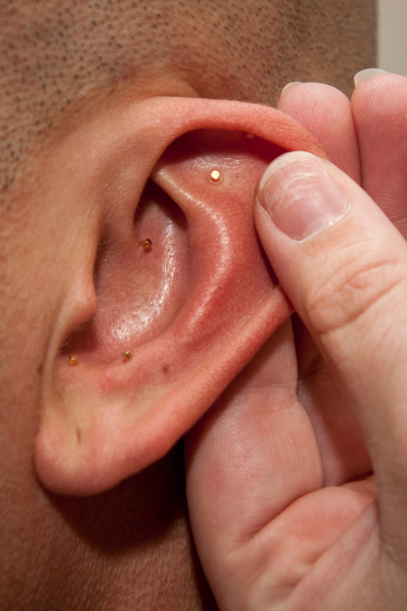 PETERSON AIR FORCE BASE, Colo. – Peterson Air Force Base medical providers are able to provide auricular acupuncture for patients experiencing acute or chronic pain. The treatment, also called battlefield acupuncture, uses needles that appear as gold studs in the ear and come out between three to seven days as the skin grows out. These are approved for military members as they are medical devices and not for decoration. (U.S. Air Force photo by Senior Airman Rose Gudex) 
