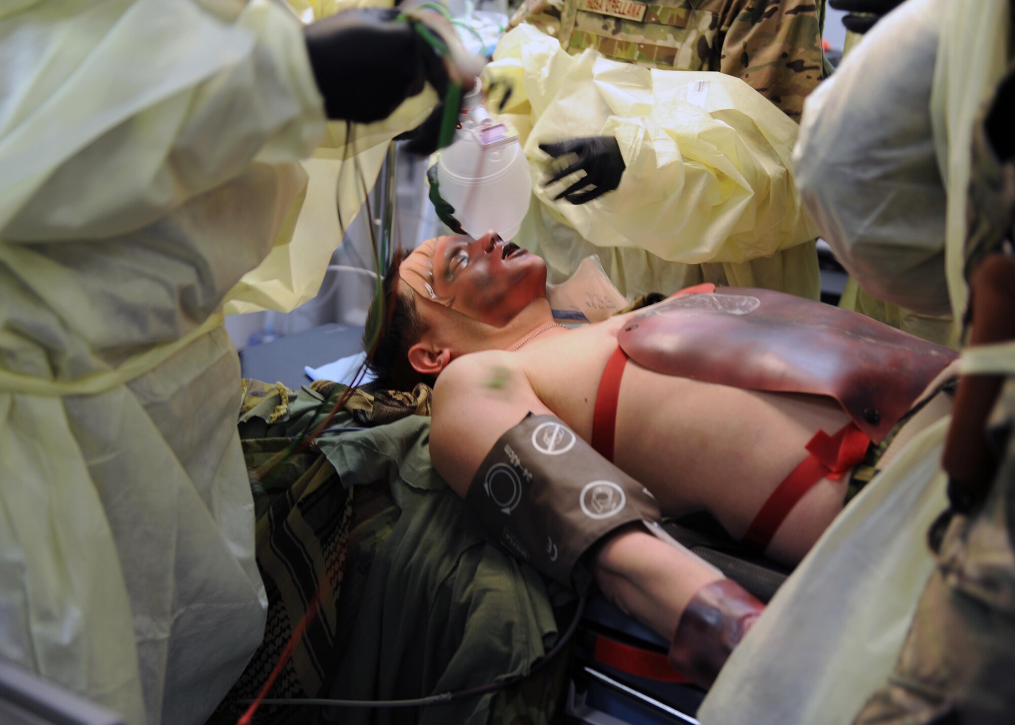 U.S. Air Force Airmen assigned to the 455th Expeditionary Medical Group tend to the simulated burns of an exercise role-player in the emergency room of the Craig Joint Theater Hospital during an exercise Feb. 6, 2015 at Bagram Airfield, Afghanistan. The exercise tested the defensive posture and emergency response preparedness of U.S. and coalition forces here. (U.S. Air Force photo by Staff Sgt. Whitney Amstutz/released)