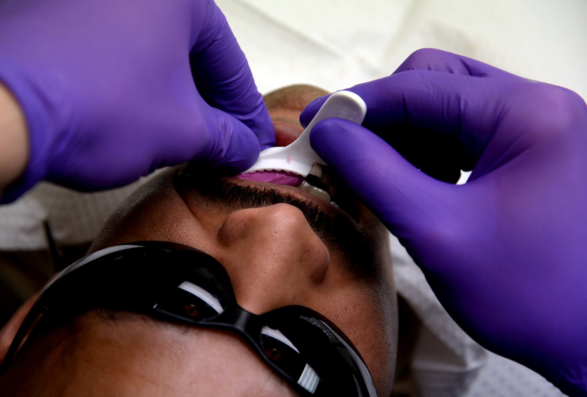 U.S. Air Force Maj. Douglas Grabowski, 48th Dental Squadron flight commander, and dentist from Chicago, uses a mold of the patient’s original tooth to create a temporary crown Feb. 20, 2015, on RAF Mildenhall, England. The mold was made before any dental work was done so it would feel like the patient’s original tooth. (U.S. Air Force photo by Senior Airman Christine Griffiths/Released)