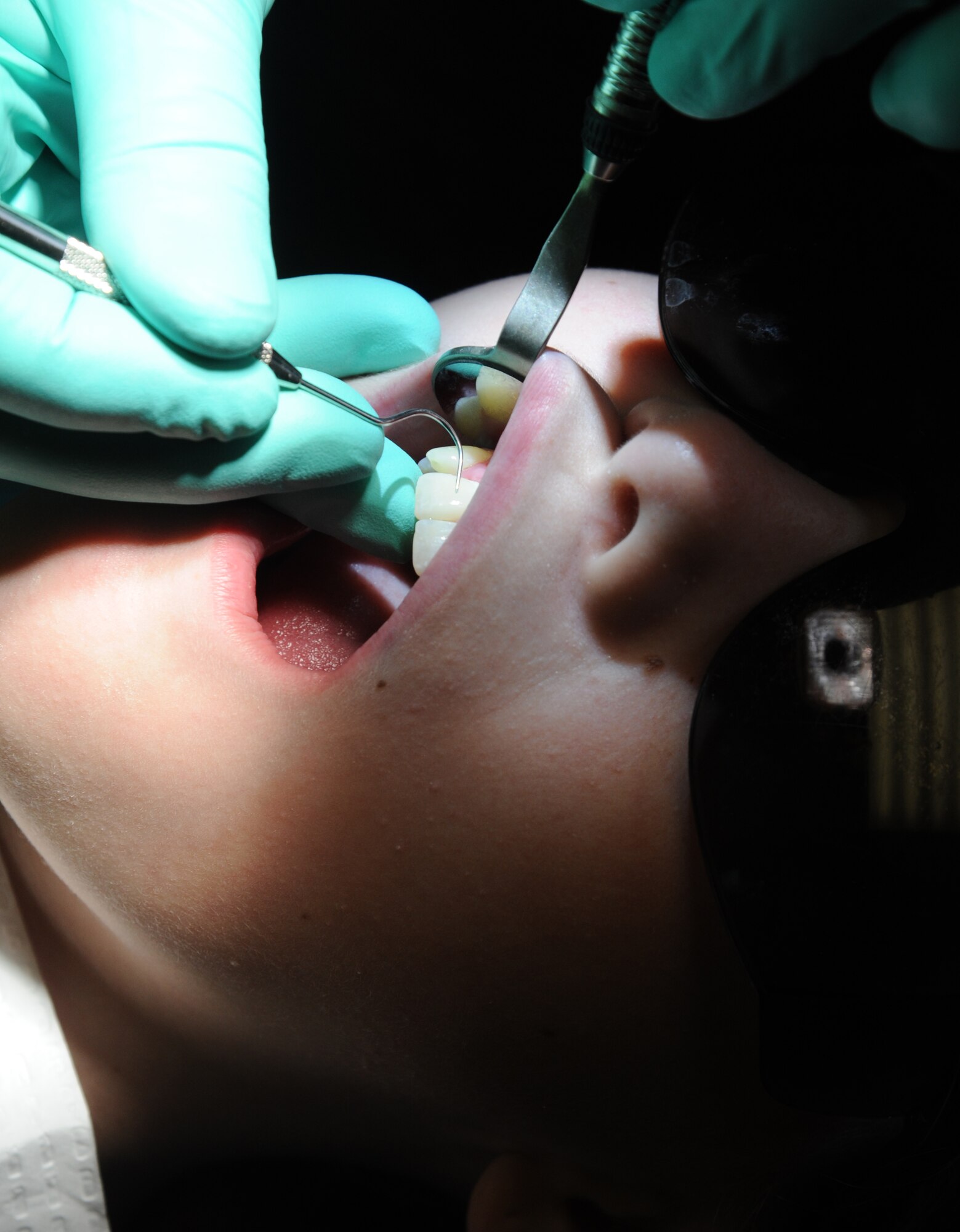 Peytyn Ferdelman receives a dental exam during the 5th annual Give Kids a Smile Day Feb. 25, 2015, at the dental clinic, Keesler Air Force Base, Miss.  The event included dental exams and cleanings for children two and older. The clinic provided approximately $14,000 in care at the free screening. Peytyn is the daughter of retired Coast Guard member William Ferdelman.  (U.S. Air Force photo by Kemberly Groue)