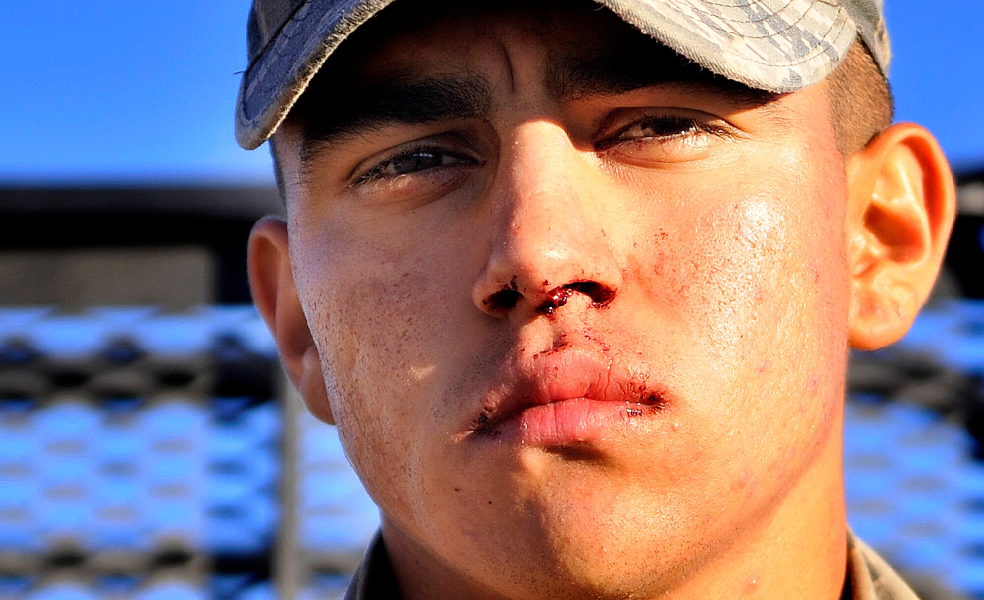 Airman 1st Class Austin Moore, 9th Security Forces Squadron member, Beale Air Force Base, California, waits to be seen by an independent medical technician due to a bloody nose caused by dehydration during the 12-mile ruck march Oct. 5, 2014, at Silver Flag Alpha range, Nevada. RAC is a two week-long leadership course designed to prepare Airmen for U.S. Army Ranger school and puts the participants through extreme physical, mental and emotional stress. (U.S. Air Force photo by Airman 1st Class Christian Clausen/Released)